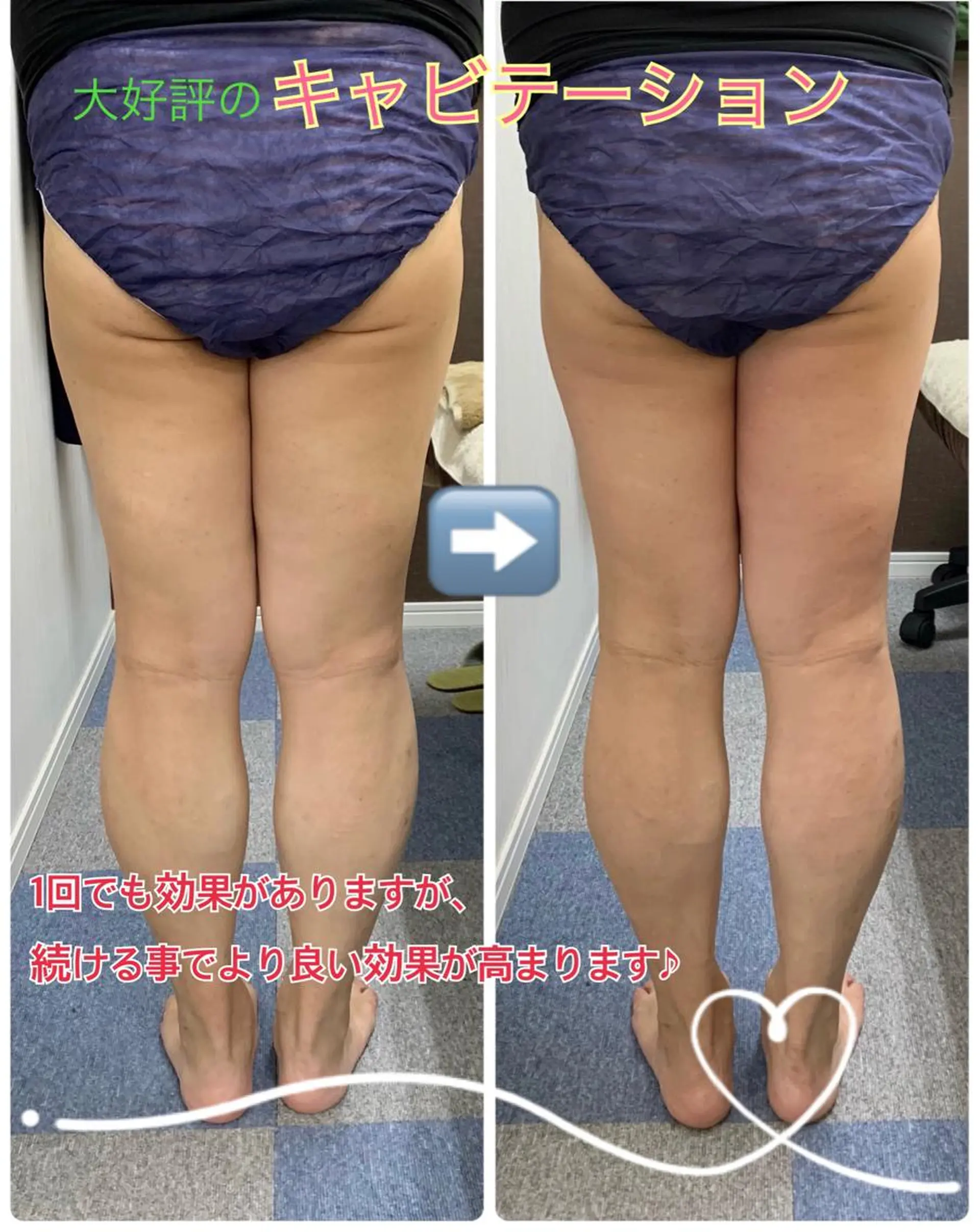 サポート鍼灸整骨院所属・サポート 鍼灸整骨院のエステ・リラクイメージ