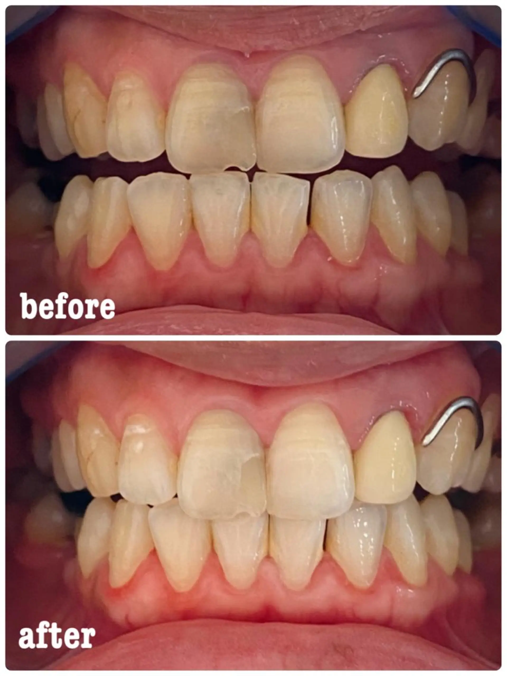 ホワイトニングサロン ラウレアのその他イメージ