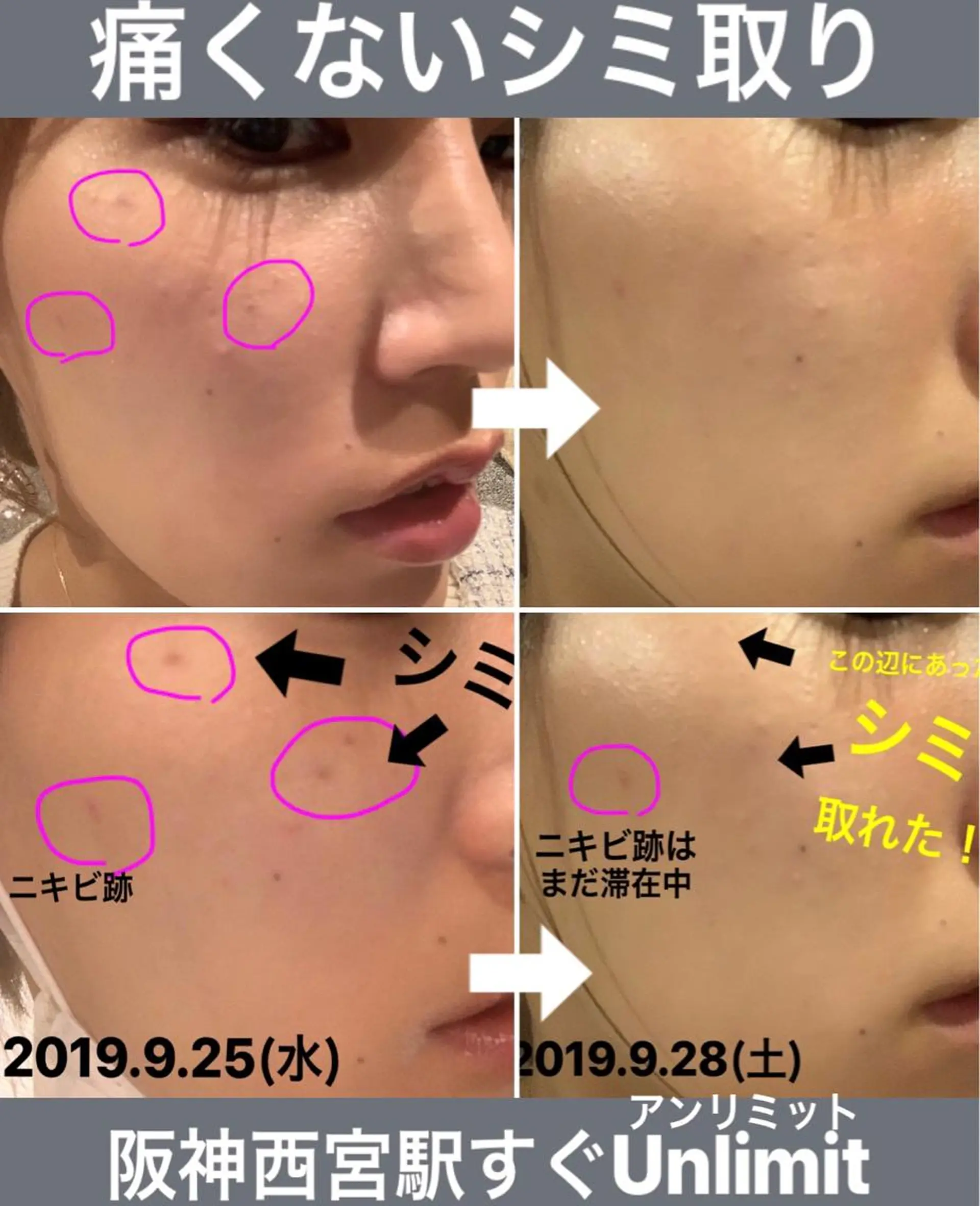 脱毛＆エステサロン【アンリミット】所属・森谷 莉美のエステ・リラクイメージ