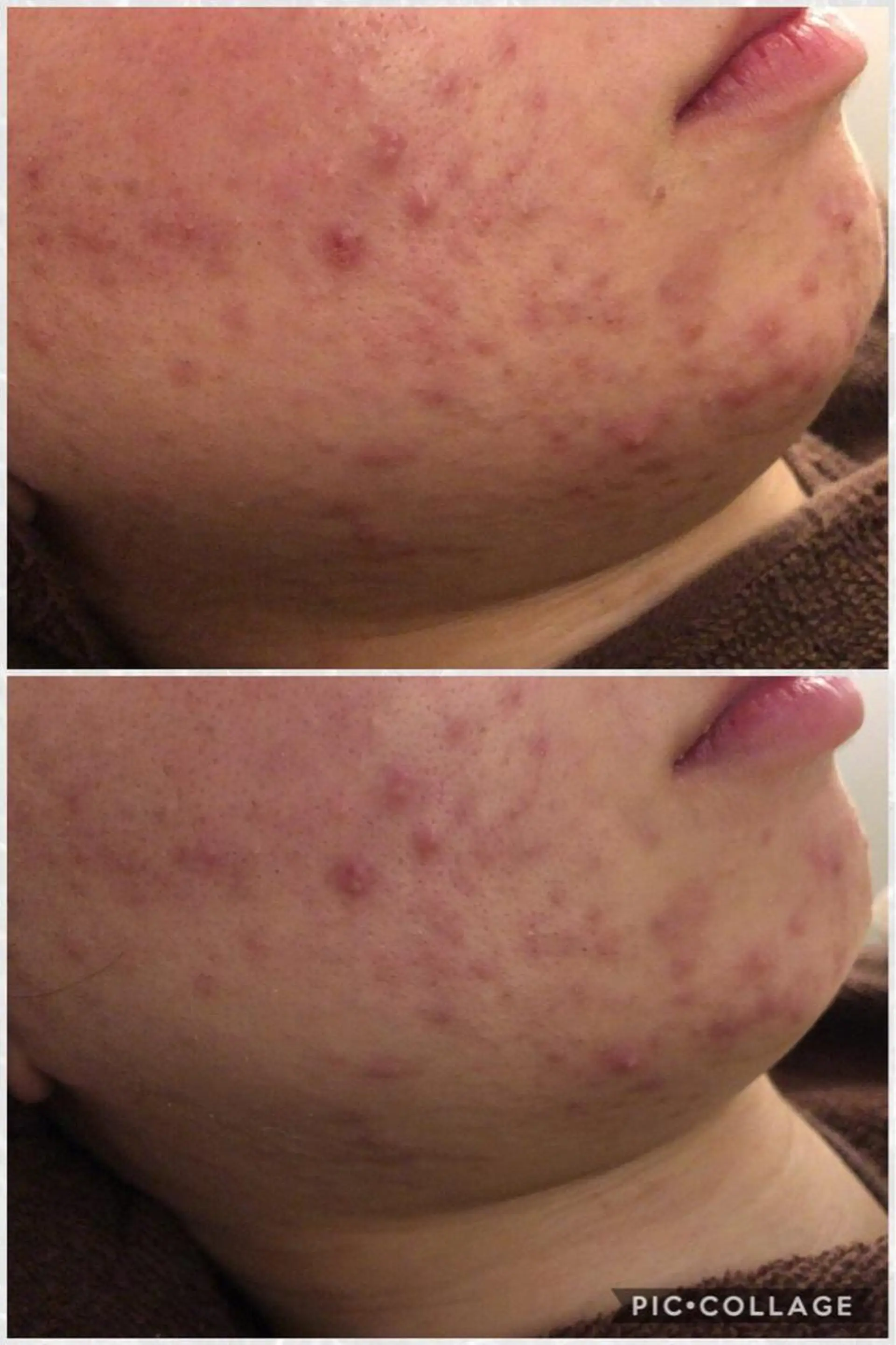 メンズ 四つ星サロン🎖 腸＆ニキビケアに特化のエステ・リラクイメージ