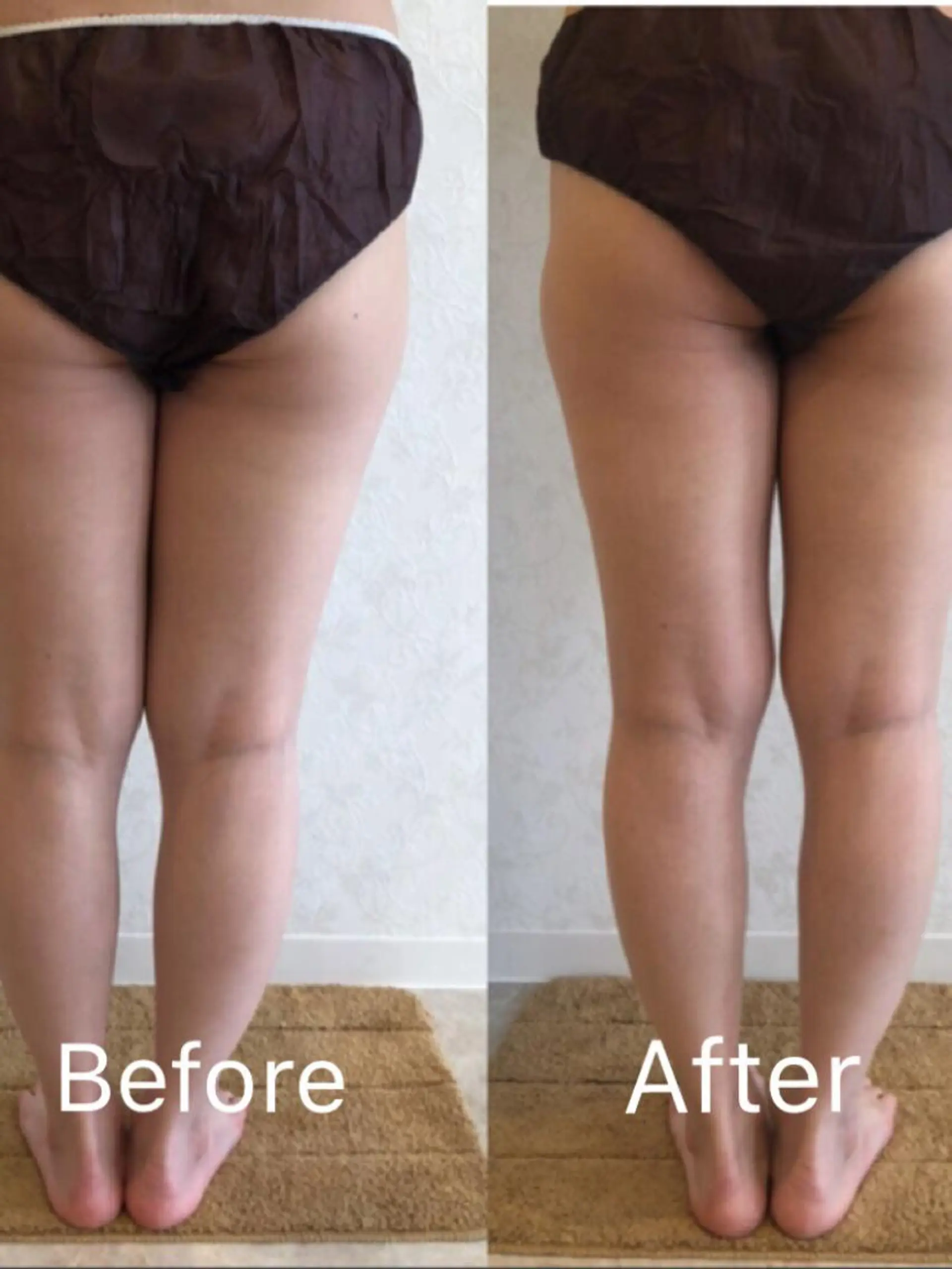 〜首・肩専門〜不調＆肌質改善サロンLiz所属・〜首・肩専門〜不調＆ 肌質改善サロンLizのエステ・リラクイメージ