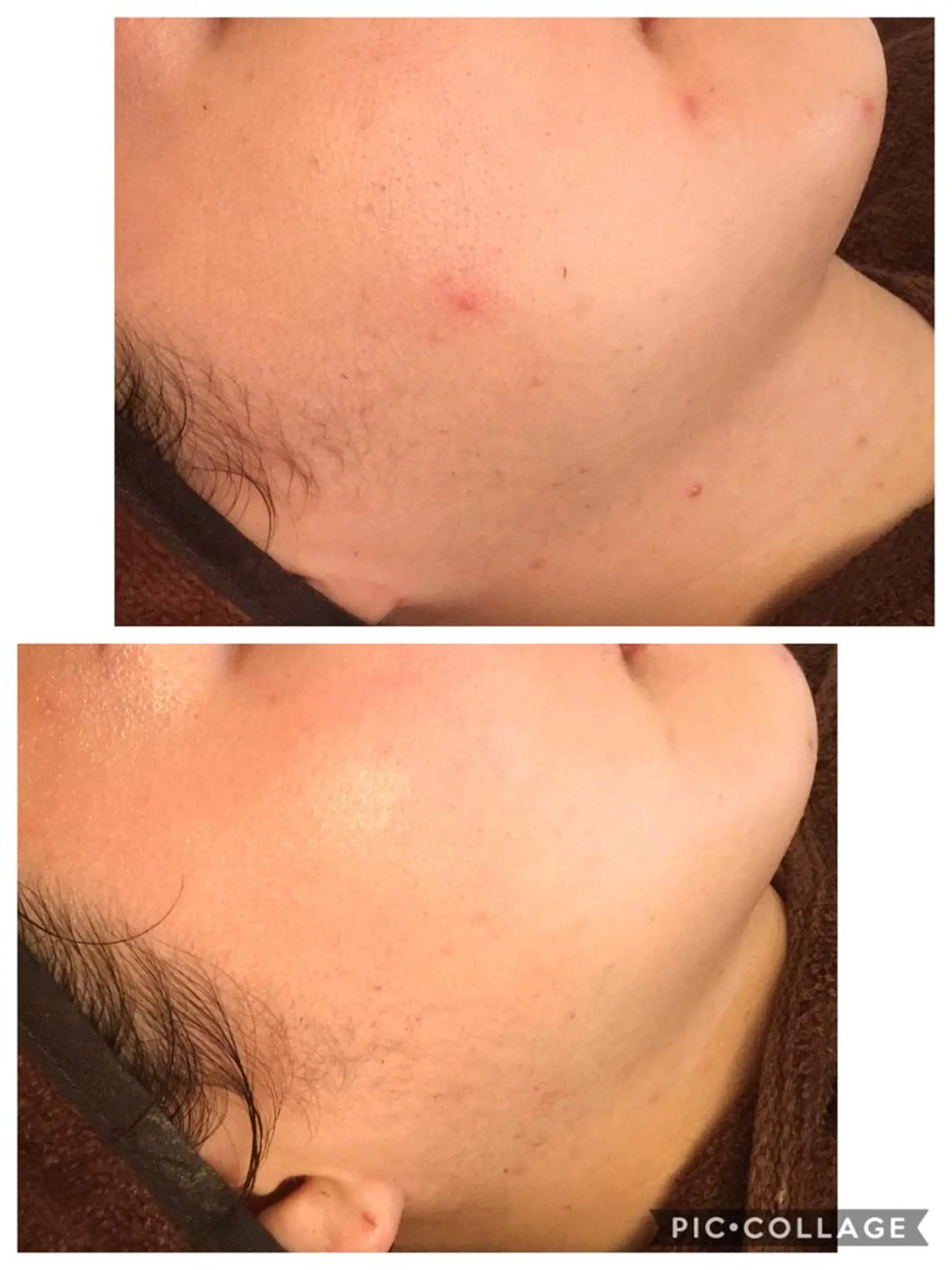 ニキビ/肌質改善専門 Snow skinのエステ・リラクイメージ