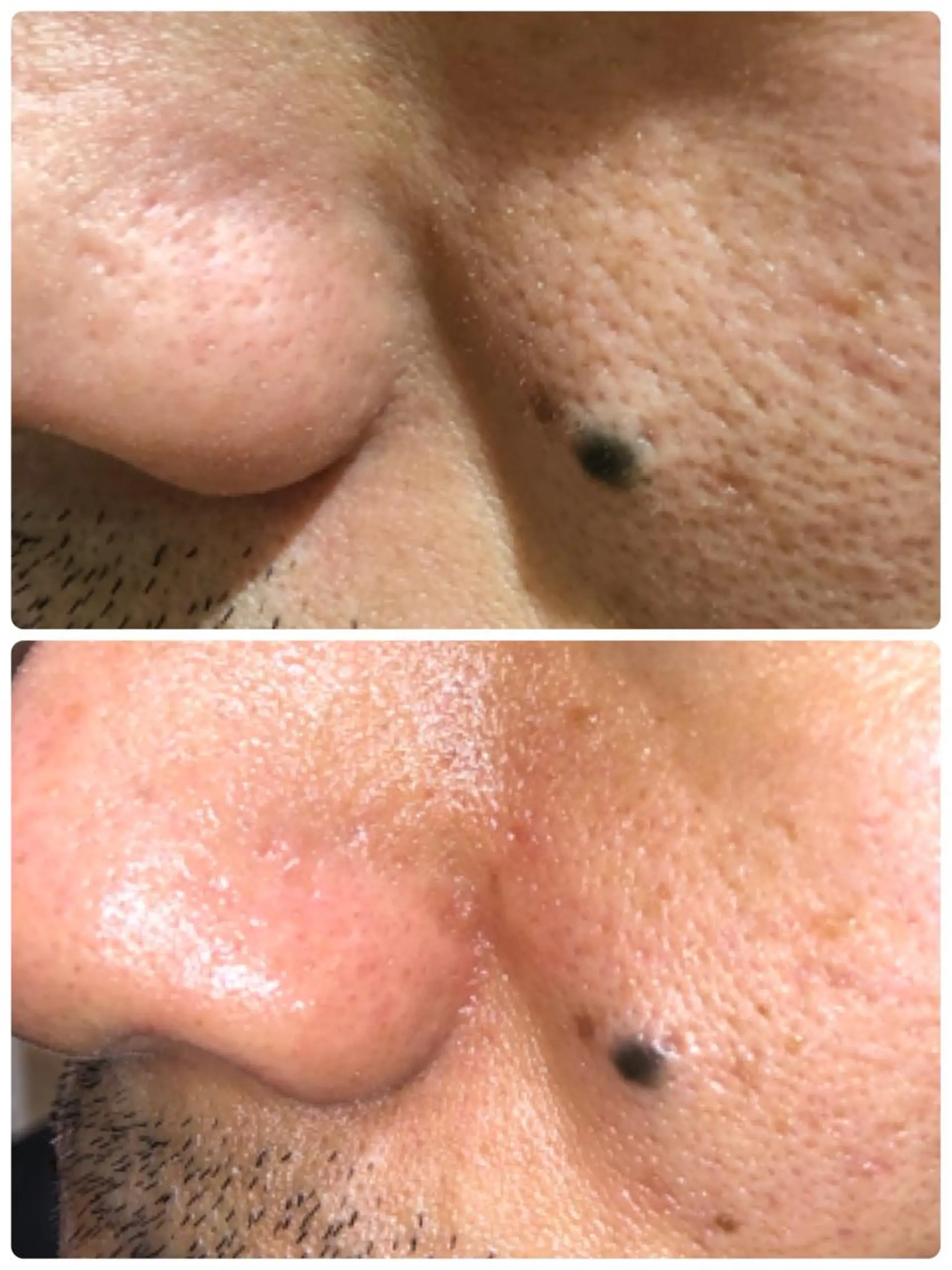 エステ トータルビューティーサロン　リコラ所属・Licola リコラのヘアスタイル