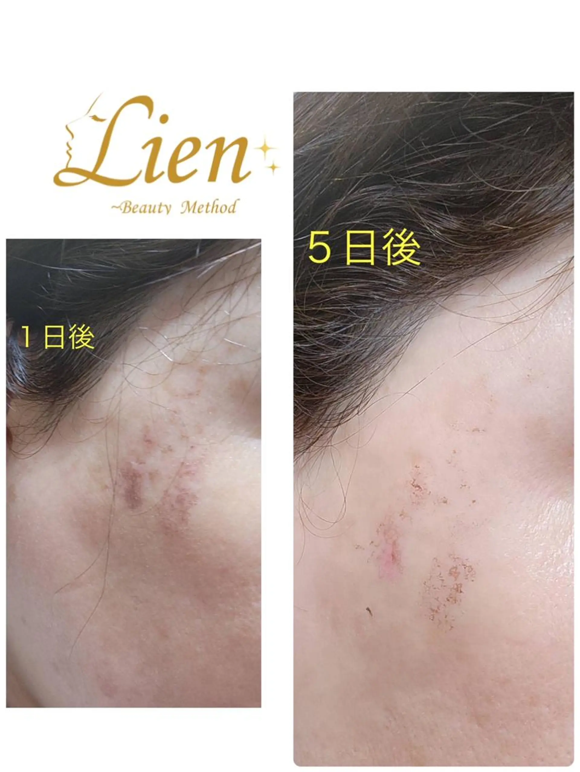 エステ Lien オーナー　山口智嘉のエステ・リラクイメージ