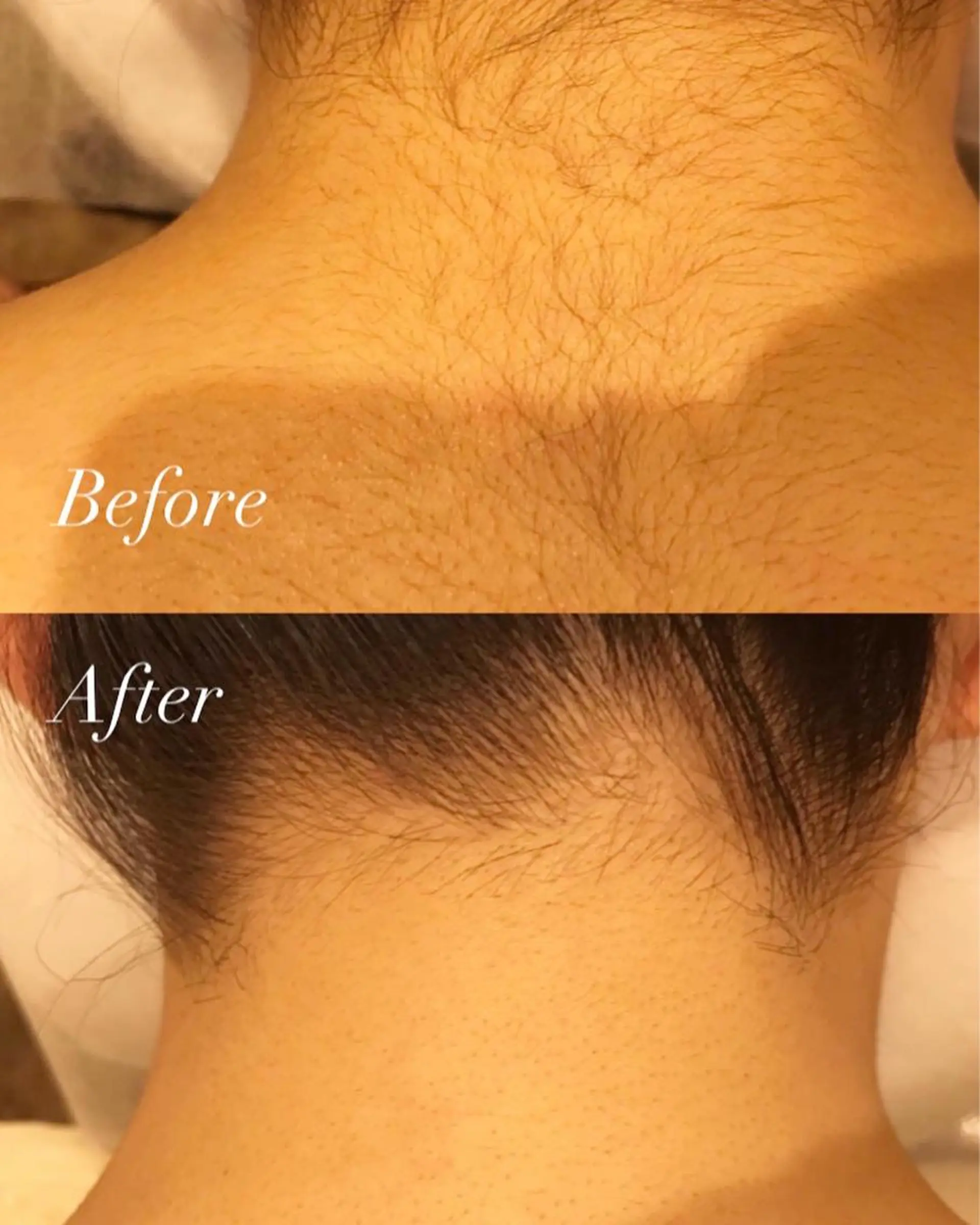 脱毛 美肌脱毛専門店 ディオーネ四日市店のエステ・リラクイメージ