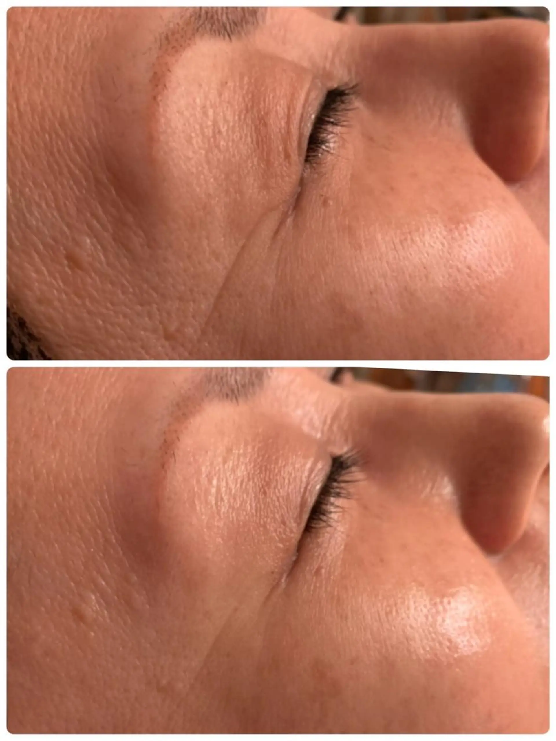 エステ aimee　肌質改善サロン【アイミー】所属・肌質改善サロン aimee｜アイミーのエステ・リラクイメージ