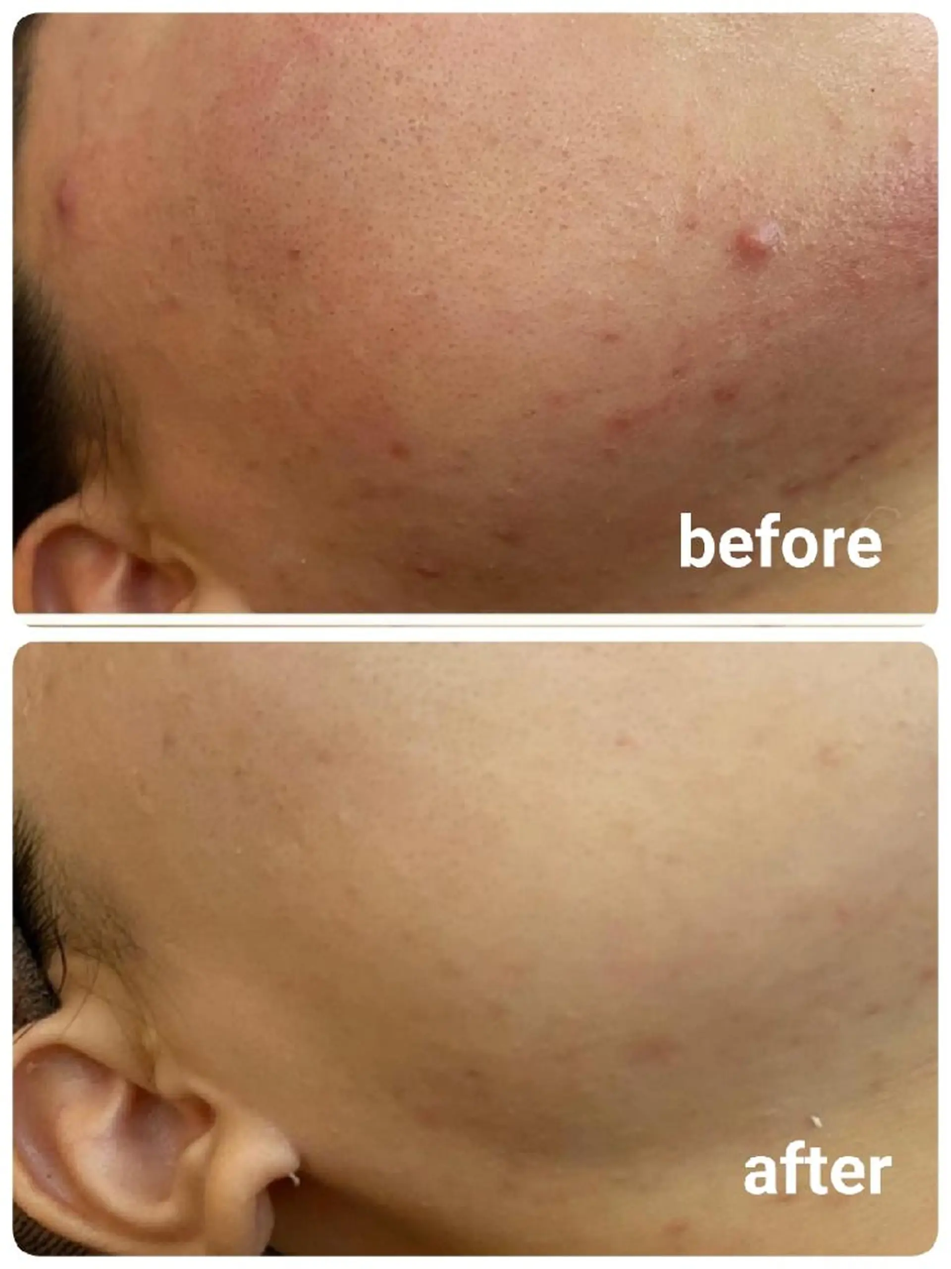 TIERRA(ティエラ)所属・TIERRA ♡のエステ・リラクイメージ