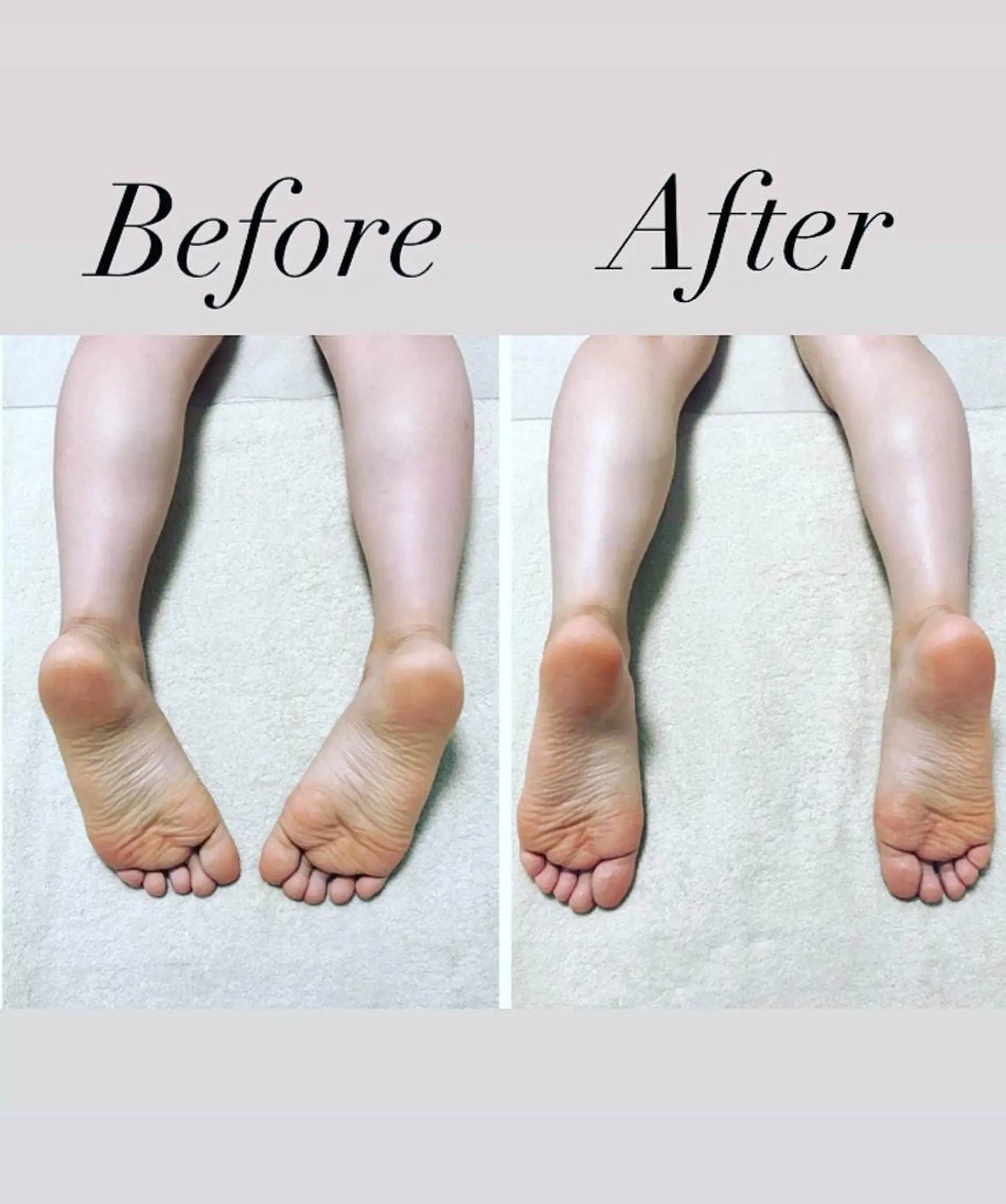 エステ La neigeのエステ・リラクイメージ