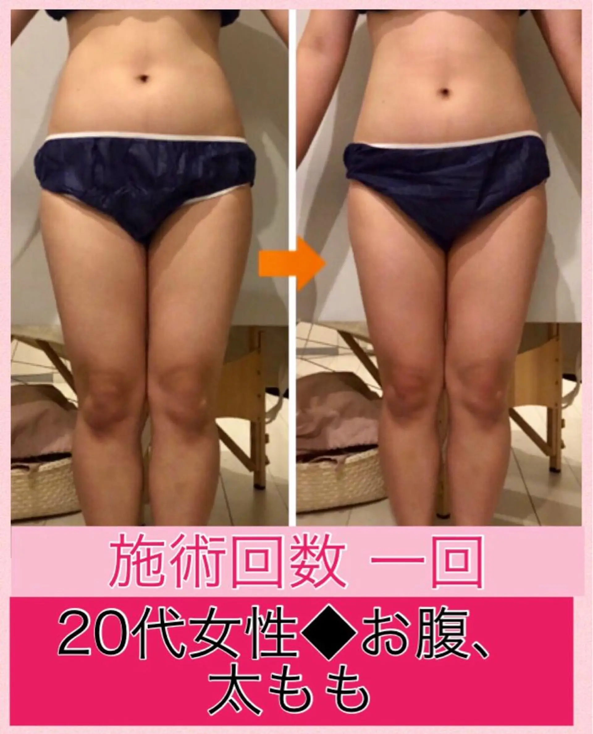 ロング カラー パーマ ヘアアレンジ メンズ キッズ ネイル マツエク・マツパ ‍痩身＆ボディ 結果出し🌟丹野のエステ・リラクイメージ