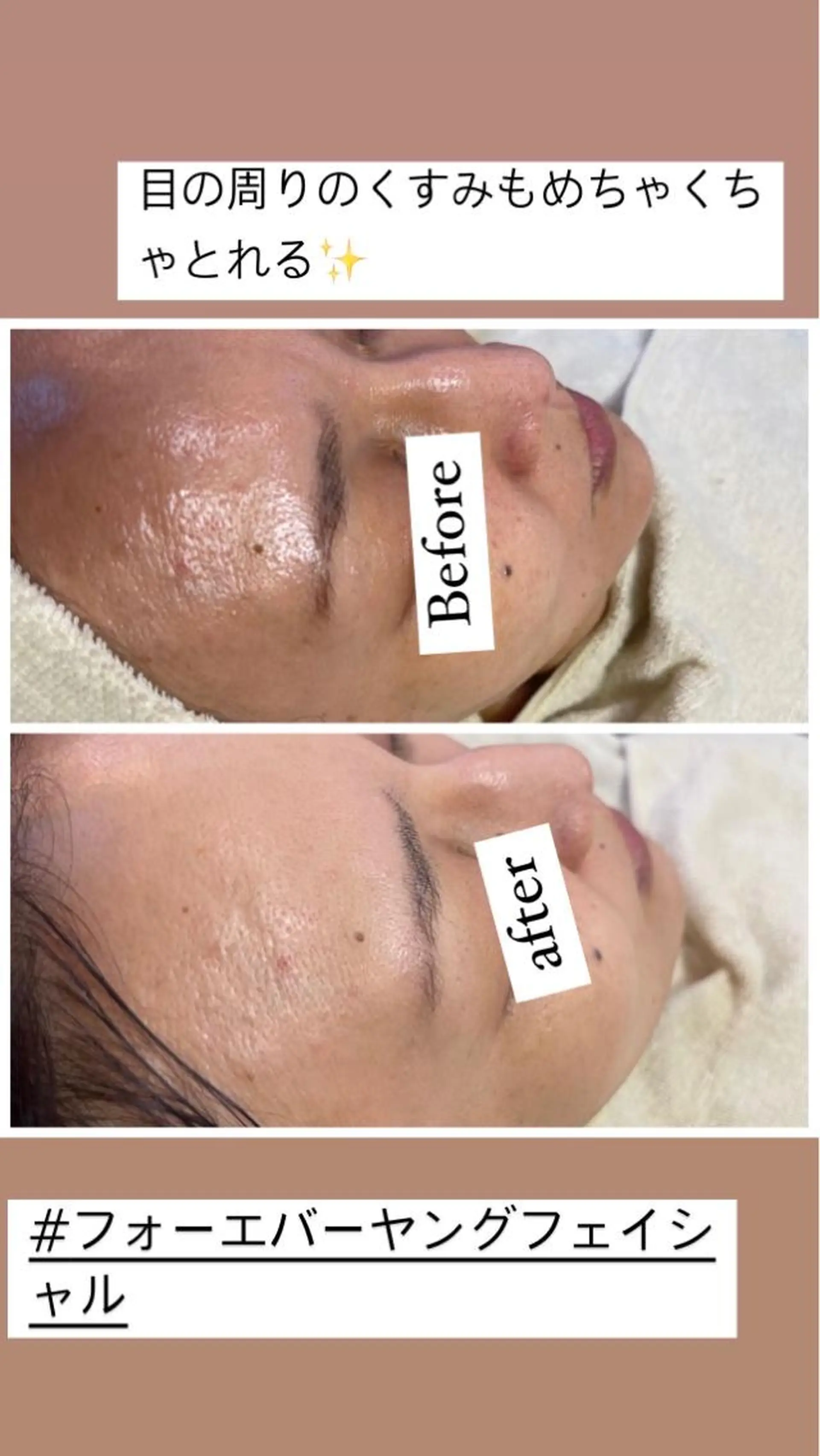 エステ 'olulapuleオルラプレ所属・olulapule オルラプレのエステ・リラクイメージ