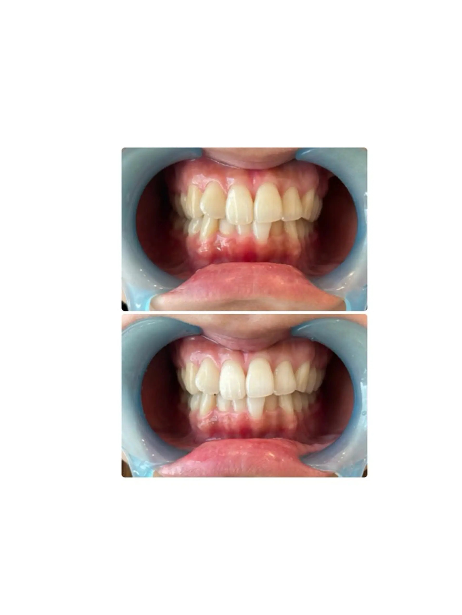 その他 Lunenail所属・Lune nailのネイルデザイン