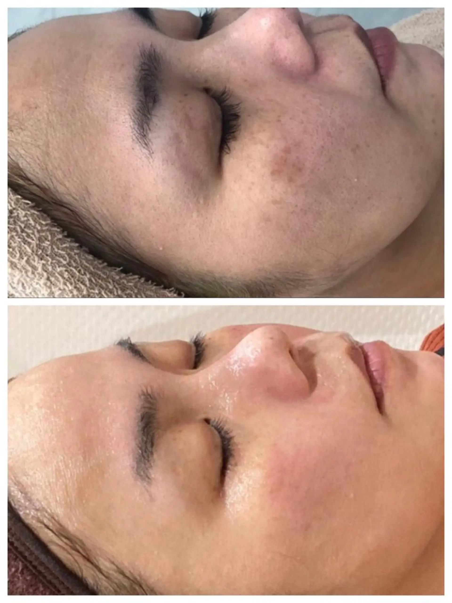 エステ HIKARI a.k.a 神童♡のエステ・リラクイメージ