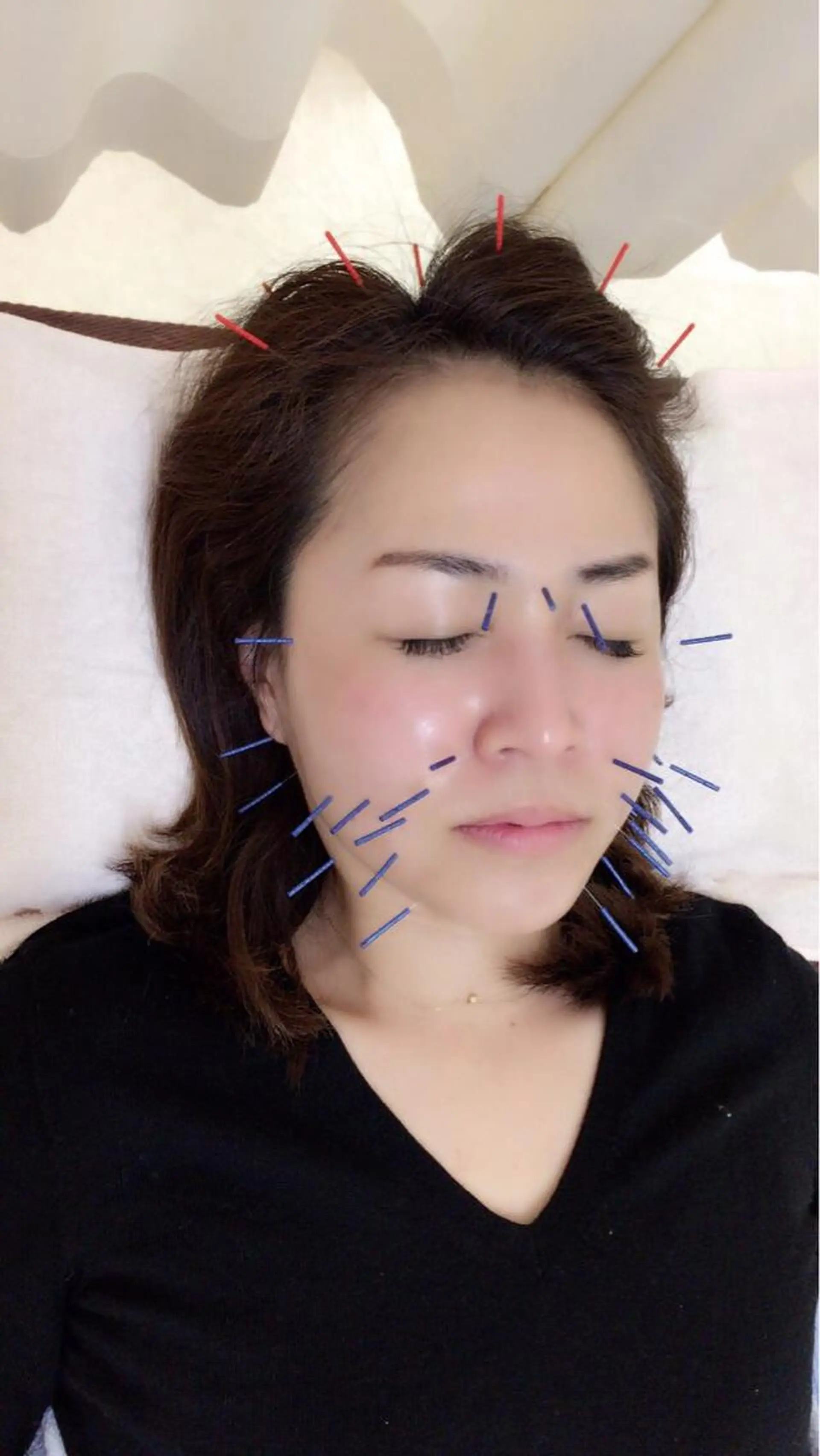 その他 やまだ鍼灸接骨院（やまだしんきゅうせっこついん）所属・山田 晃のエステ・リラクイメージ