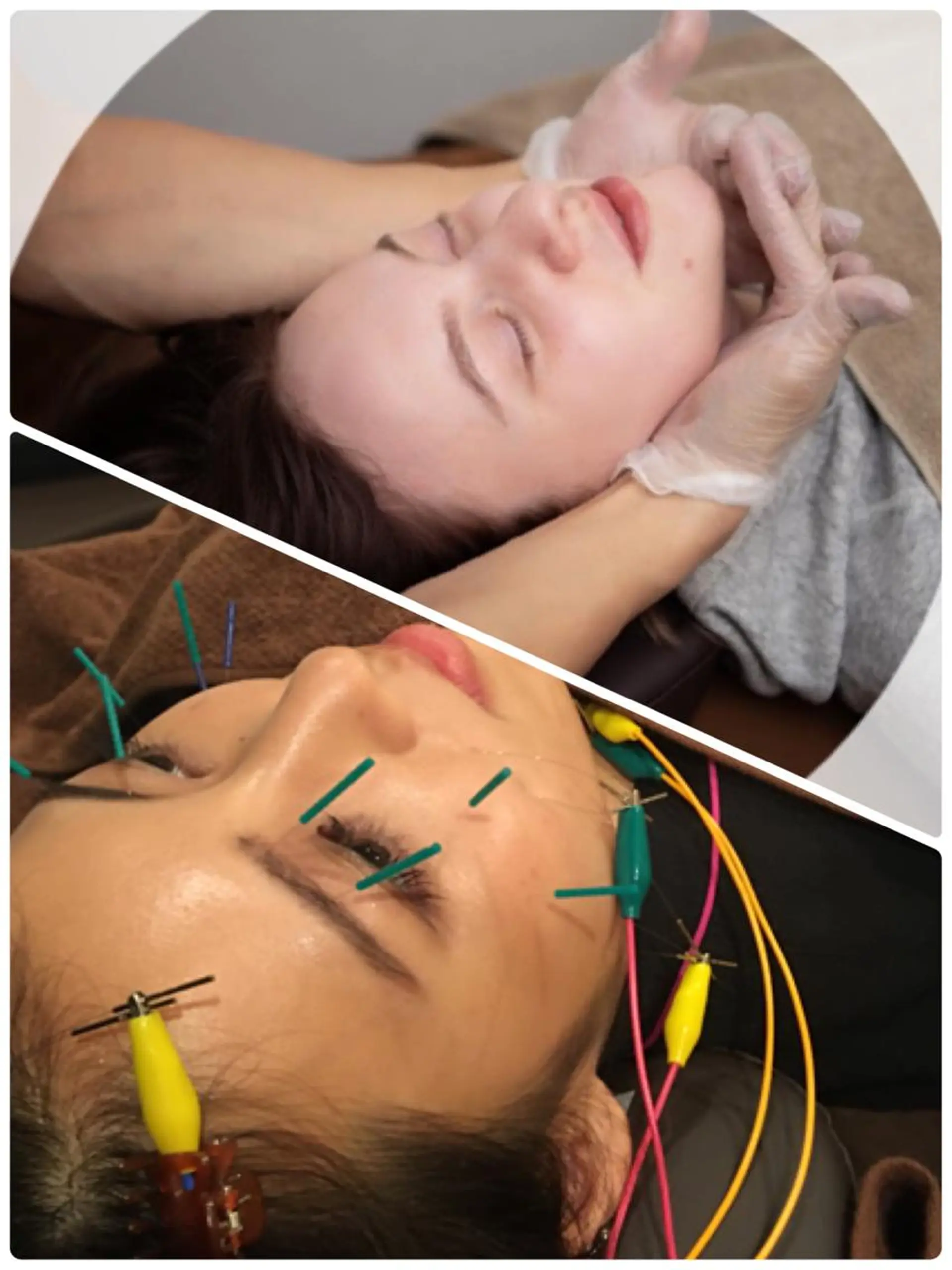 表参道鍼灸院K 美容鍼🔮ララピールのエステ・リラクイメージ