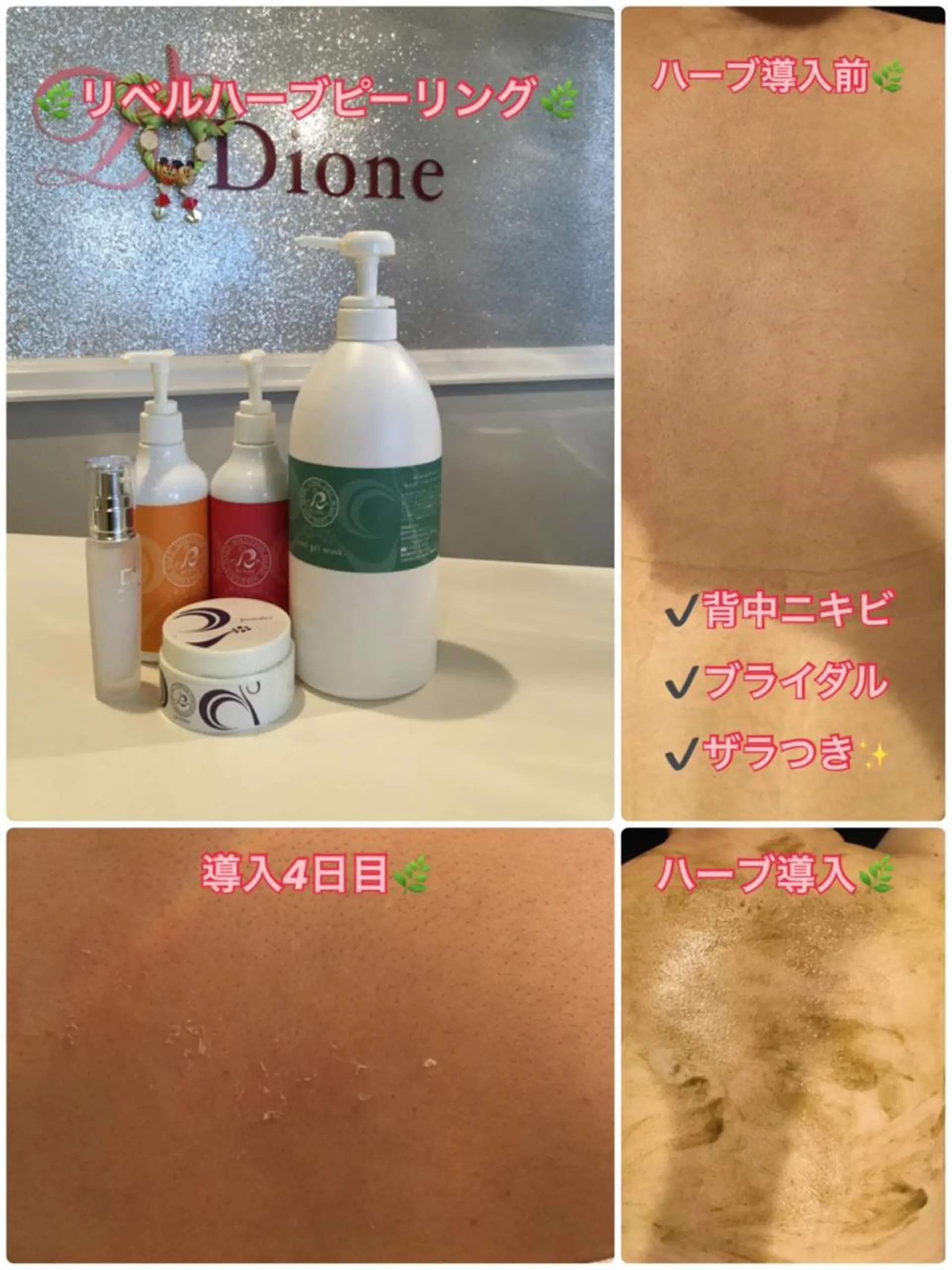 エステ 【リベルハーブピーリング認定店】敏感肌・美白脱毛専門店Dione立川店所属・Dione 立川店のエステ・リラクイメージ