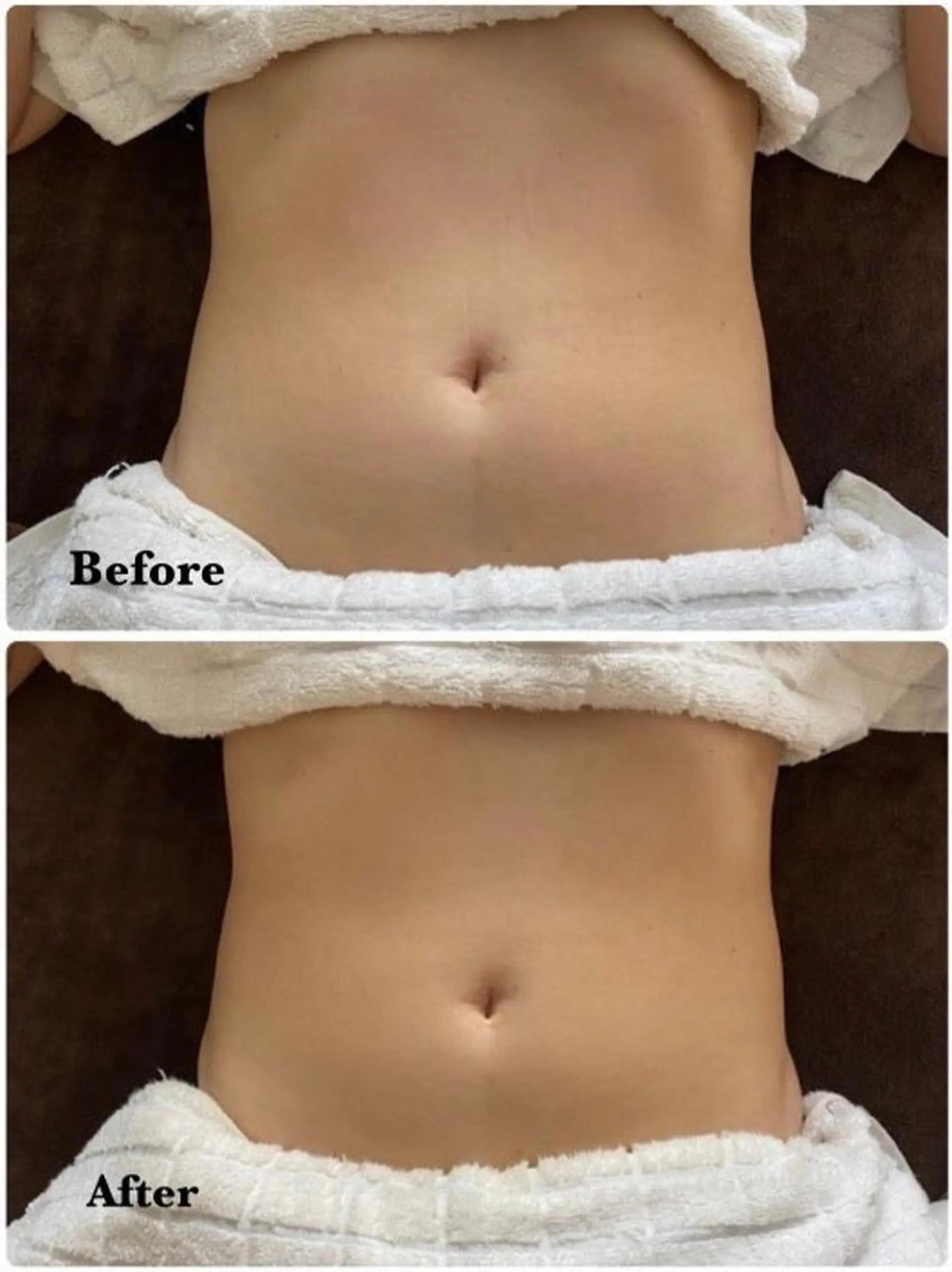 Salon Rosé 🌿漢方🌿足痩せのエステ・リラクイメージ