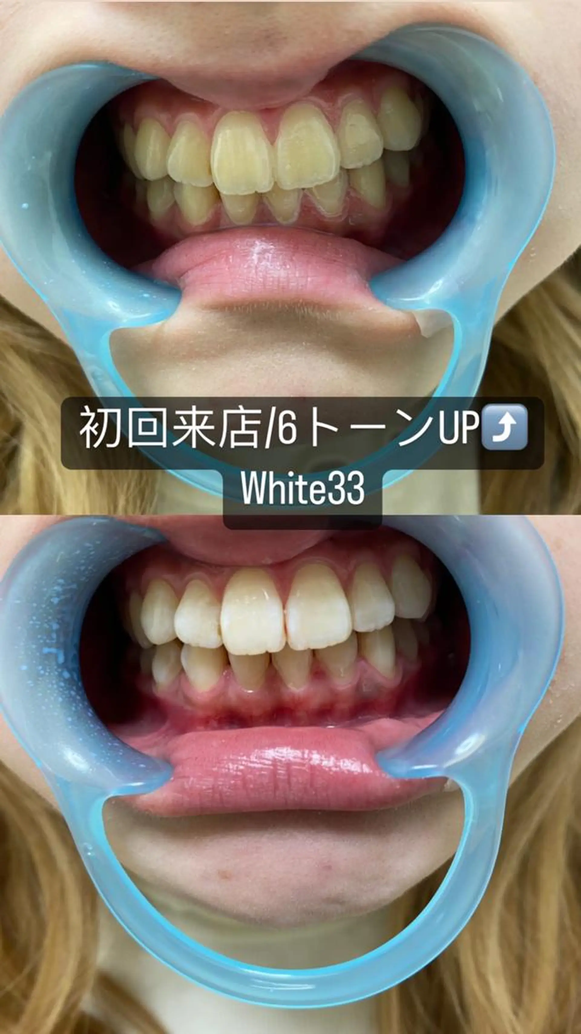 メンズ セルフホワイトニング White33大名のその他イメージ