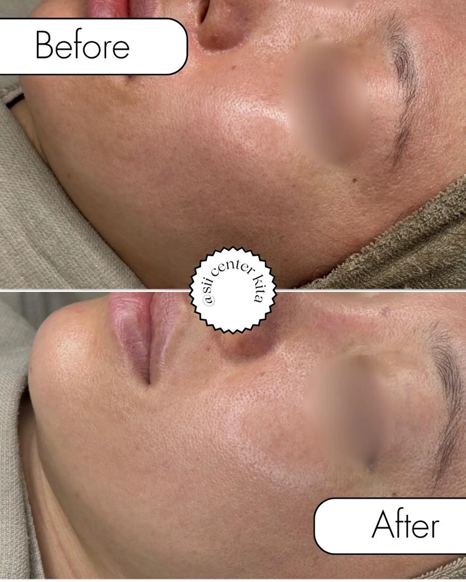 OAK×NACHUL 成城学園前のエステ・リラクイメージ