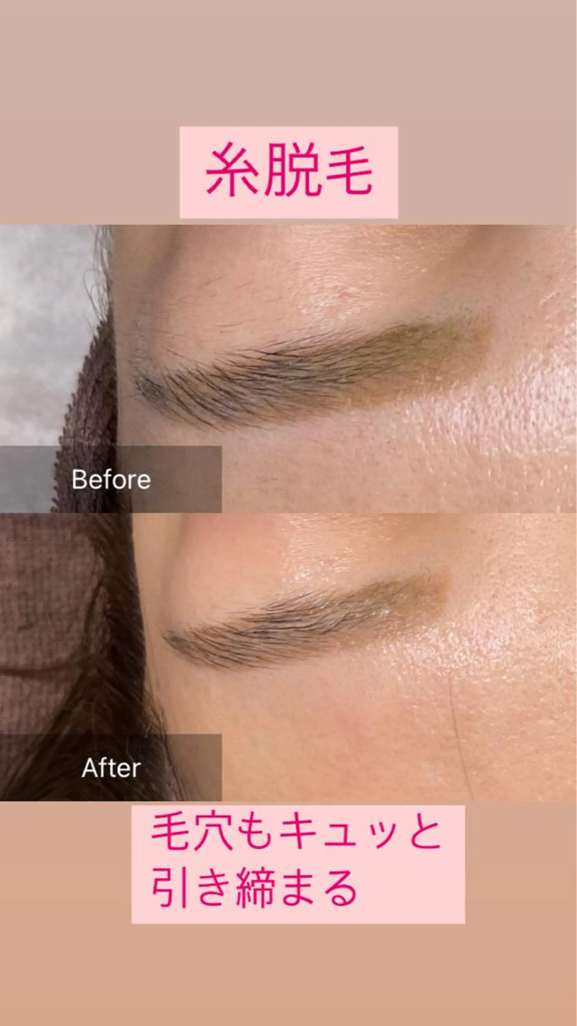 エステ 産毛専門店 Bittoのエステ・リラクイメージ