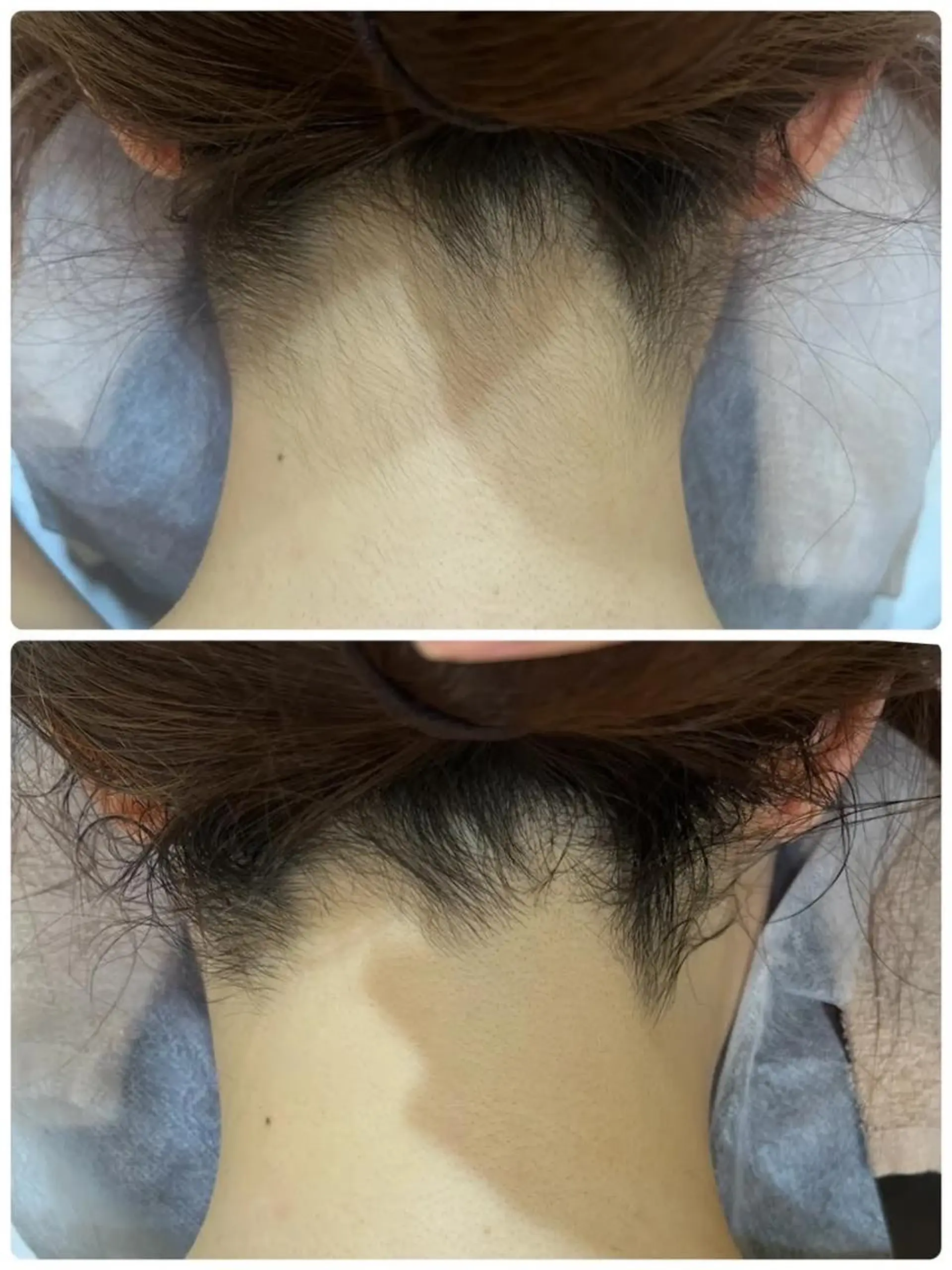 脱毛 レイビス 渋谷店のエステ・リラクイメージ