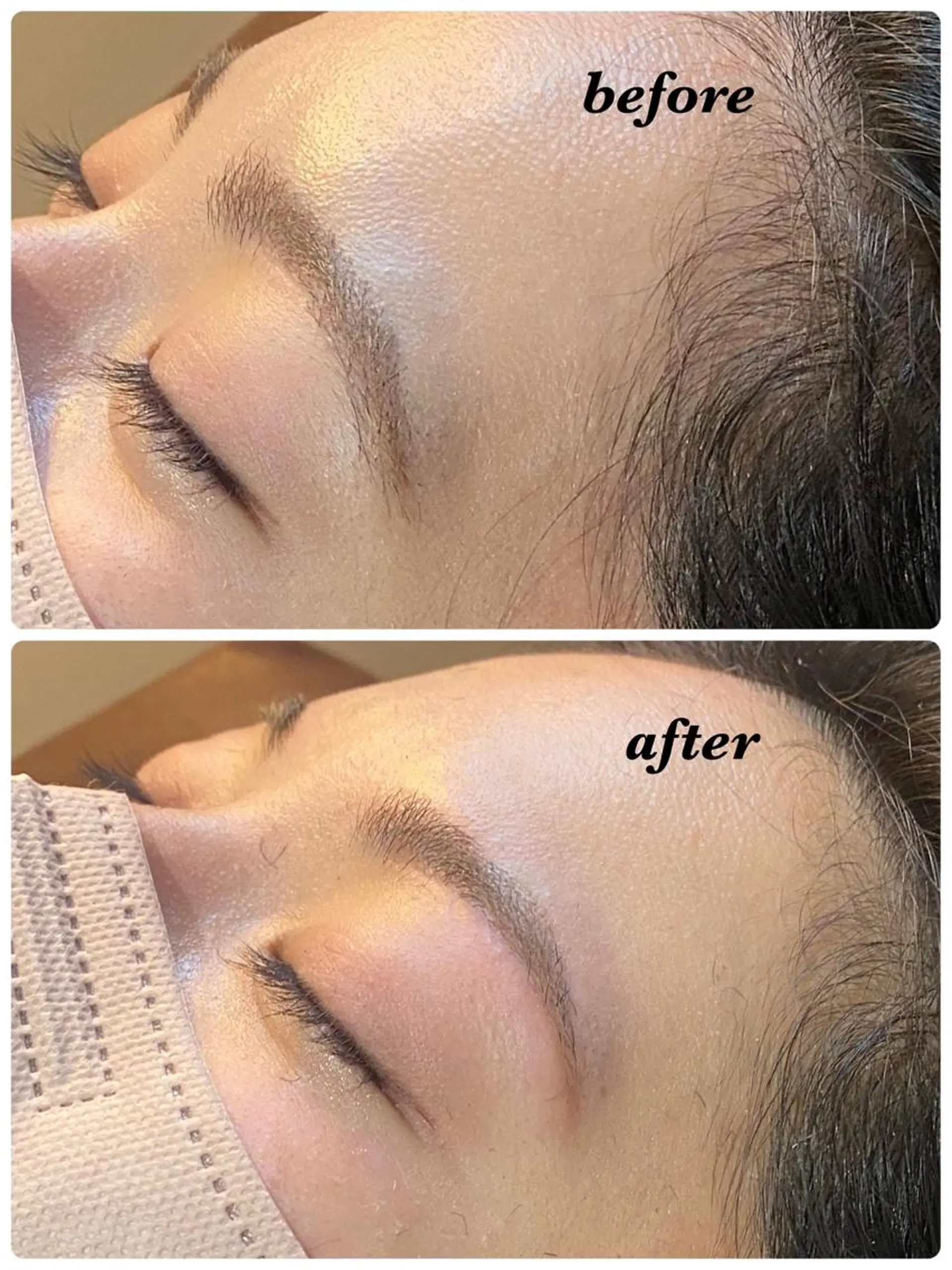 アイブロウ ハーブピーリング/韓国肌管理/フェイシャル/毛穴洗浄/眉毛/顔脱毛【糸脱毛専門】rev所属・ハーブピーリング🌹 毛穴洗浄❤️眉waxのエステ・リラクイメージ