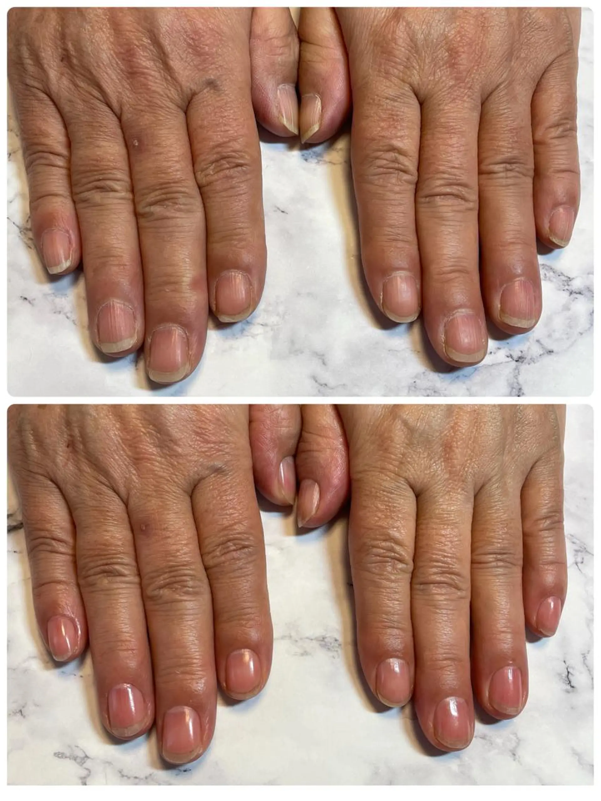 ネイル 高野 祐紀のネイルデザイン