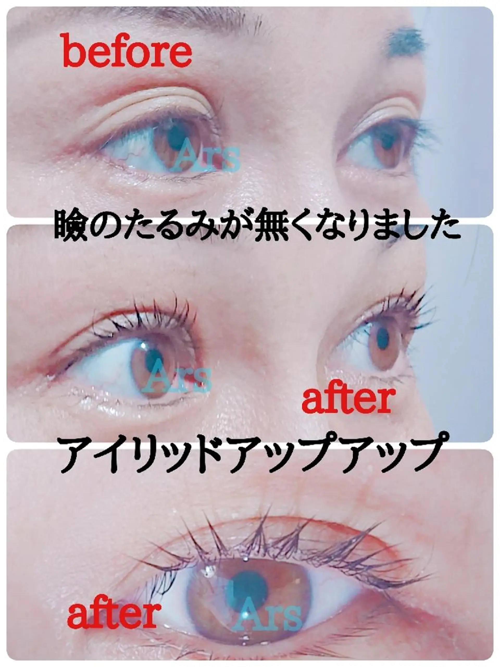 メンズ マツエク・マツパ メンズパーマ アイリッドアップパーマ Ars  (ｱﾙｽ)所属・Ars      (ｱﾙｽ)のマツエク・マツパデザイン