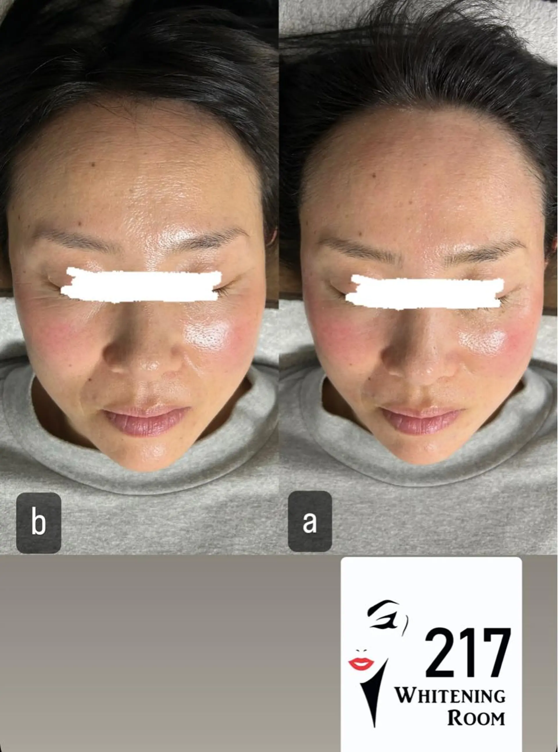 217whitening  room所属・217 ホワイトニングルームのエステ・リラクイメージ