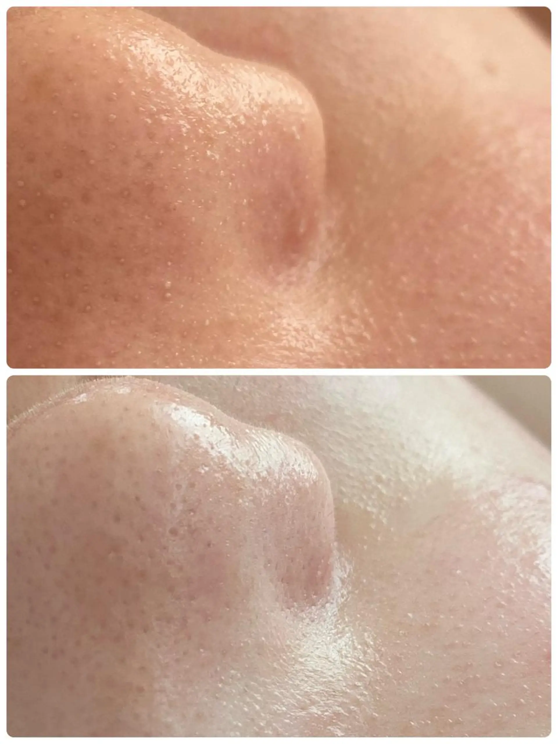 Chalon所属・REVI取扱・肌悩み 毛穴Chalonのエステ・リラクイメージ