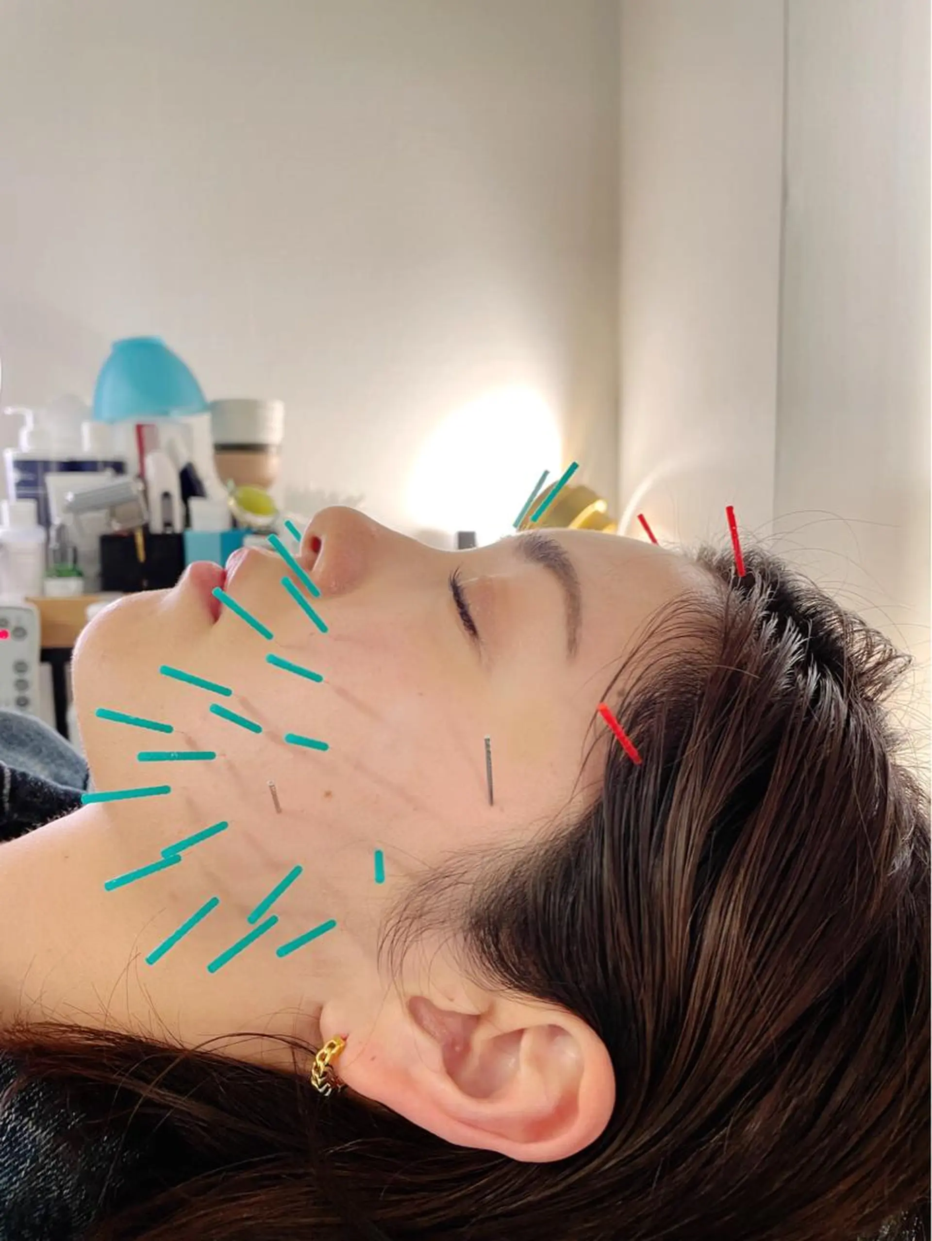 エステ リラク 小顔美容鍼専門サロン 渋谷YZのその他イメージ