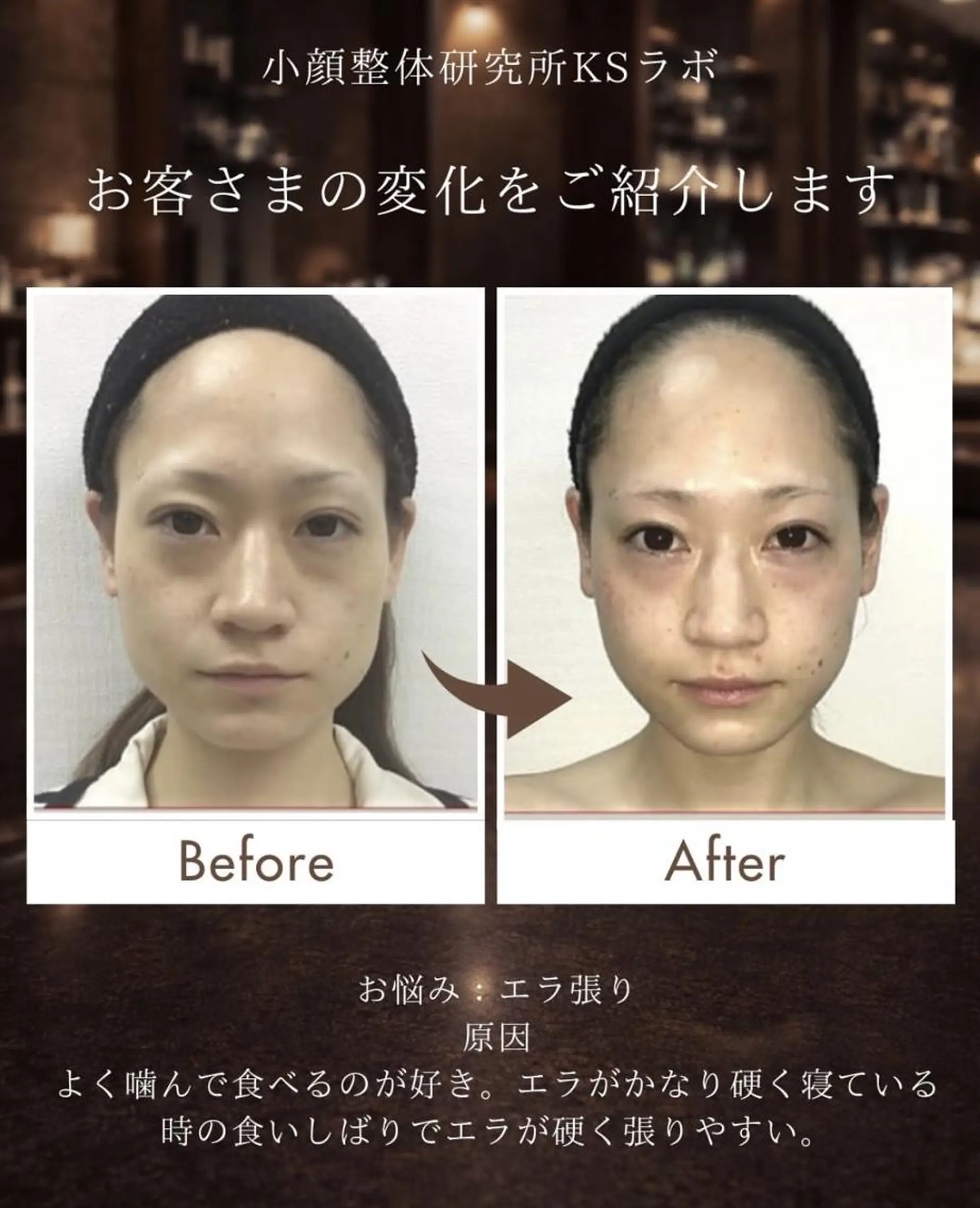 小顔整体研究所 KSラボ川崎店内田のエステ・リラクイメージ