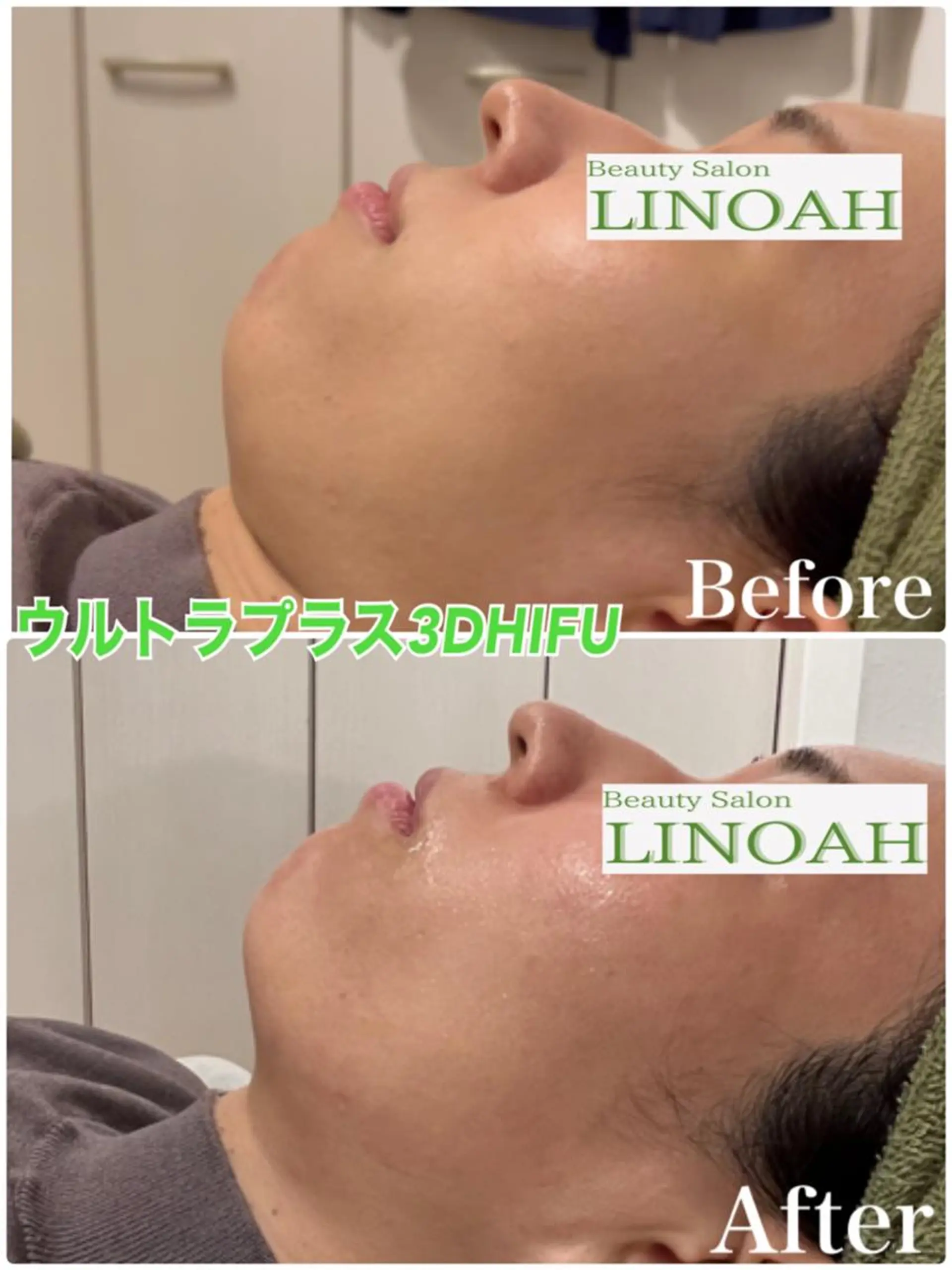 マツエク・マツパ アイブロウ メンズ エステ リラク ビューティーサロン リノアのエステ・リラクイメージ