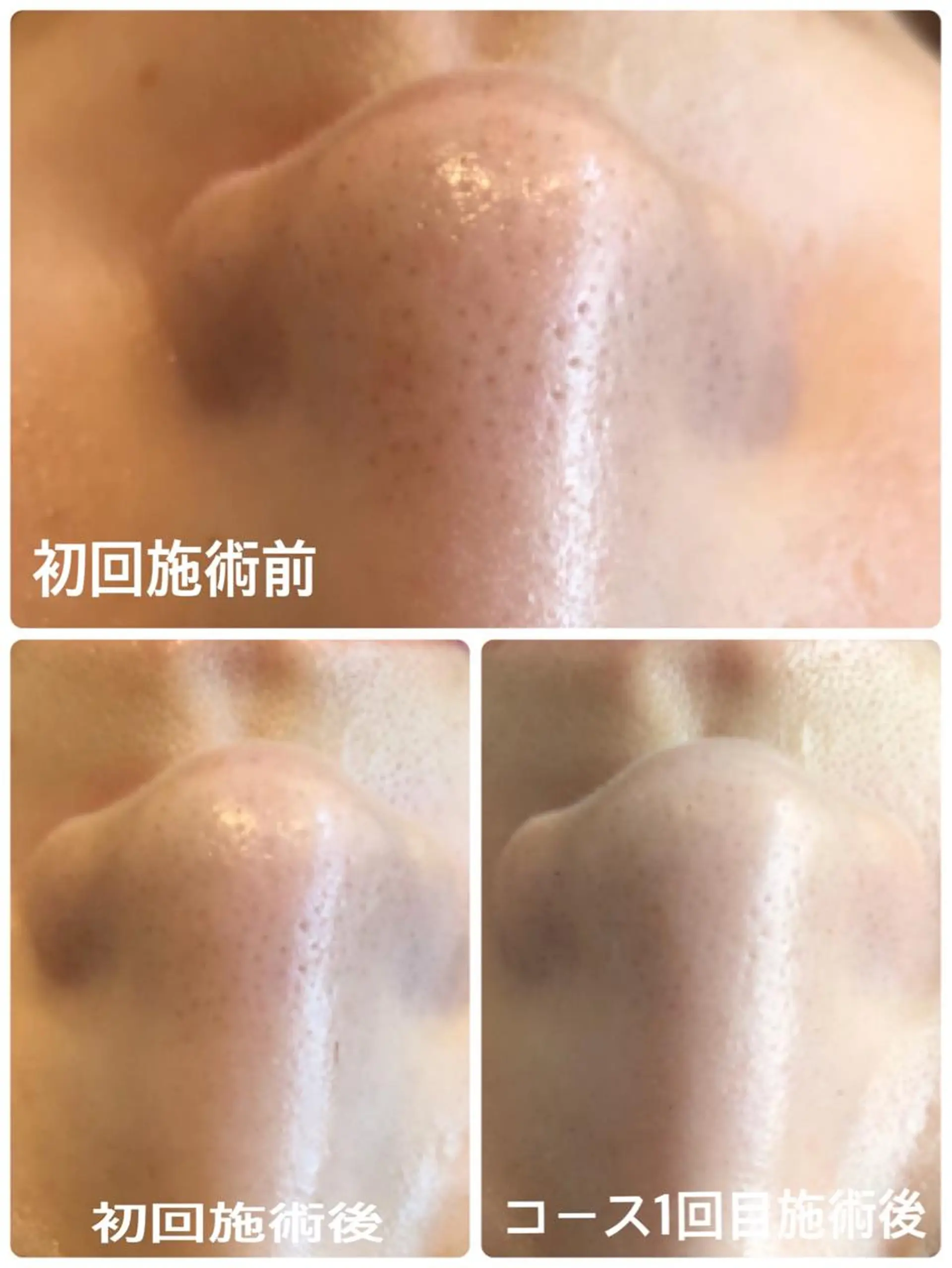 LILIANA所属・LILIANA ☆YURIのエステ・リラクイメージ