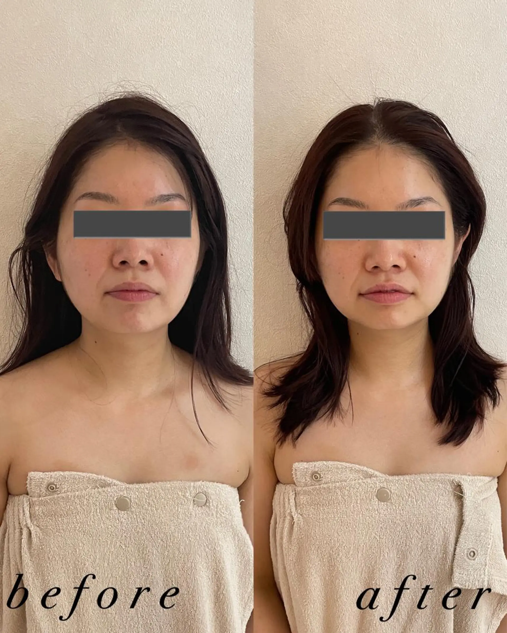 うなじ脱毛/美肌脱毛 LABELのエステ・リラクイメージ