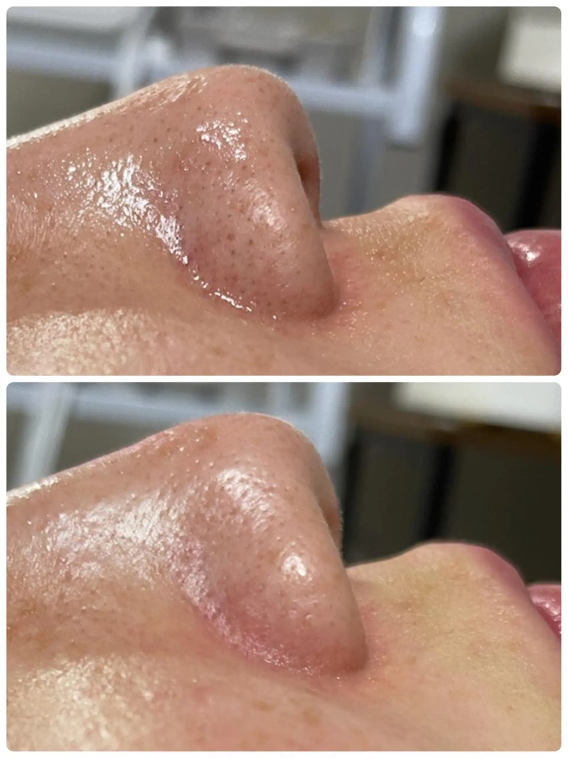 エステ／ネイル/脱毛 R.Msalonのネイルデザイン