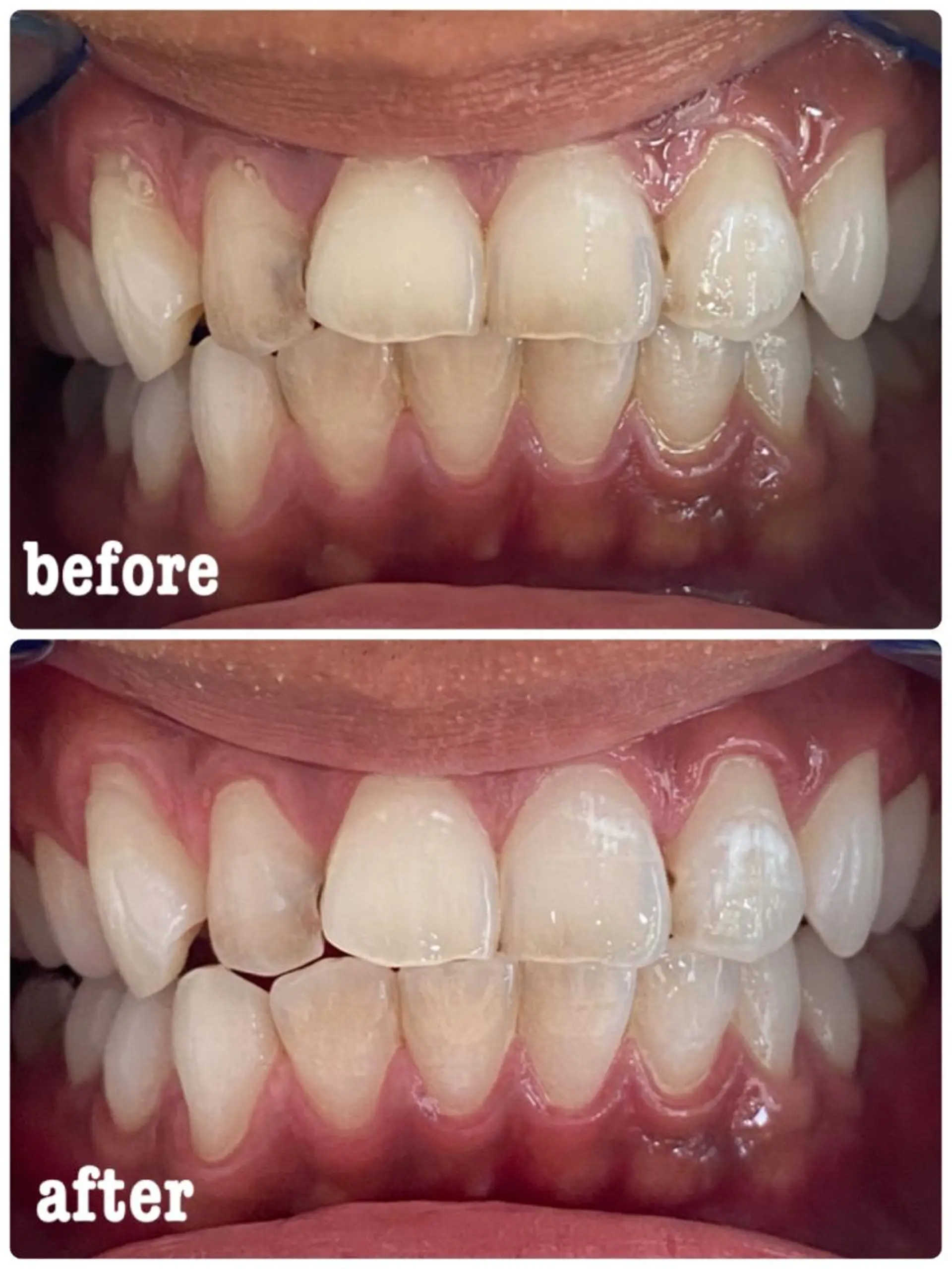 ホワイトニングサロン ラウレアのその他イメージ