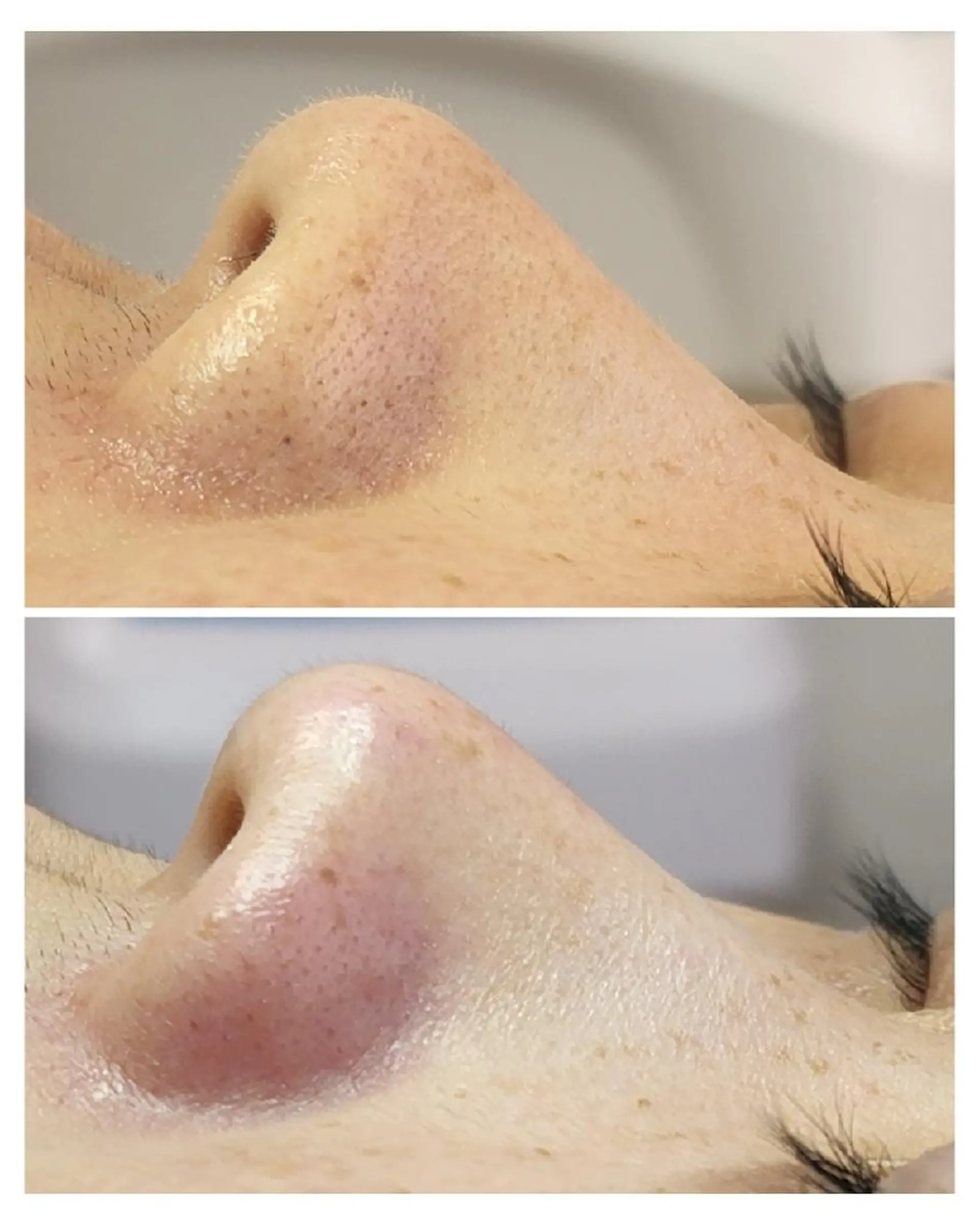 エステ ALOHA RETREATのエステ・リラクイメージ