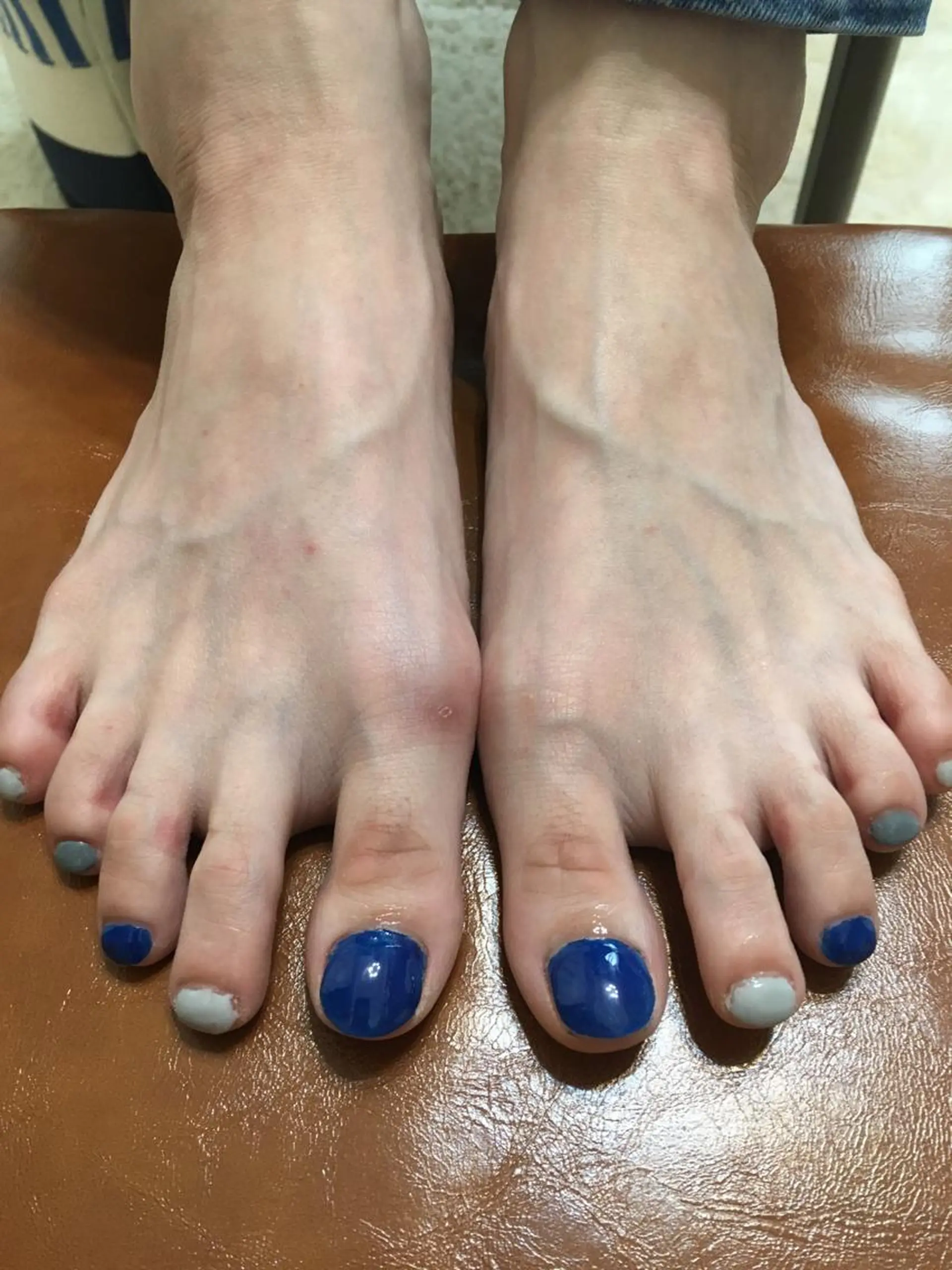 ネイル ブルー フットネイル フットネイル 🌈KANÅKO 🌈のネイルデザイン