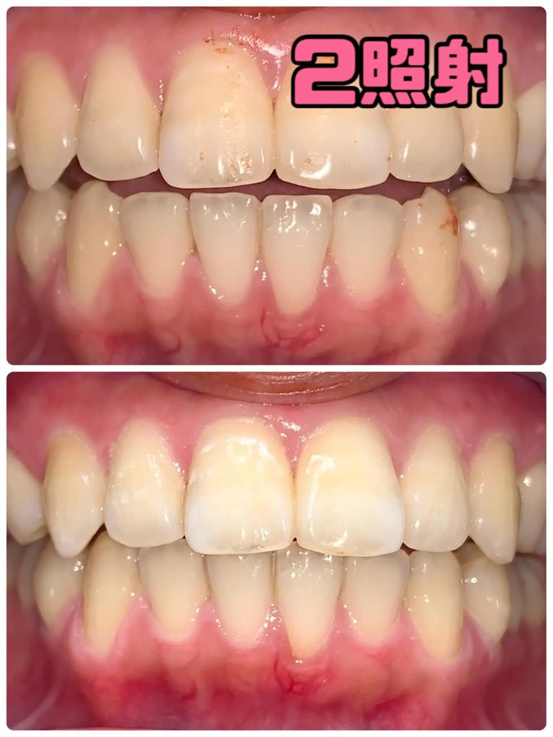 LOVE ホワイトニング渋谷のその他イメージ