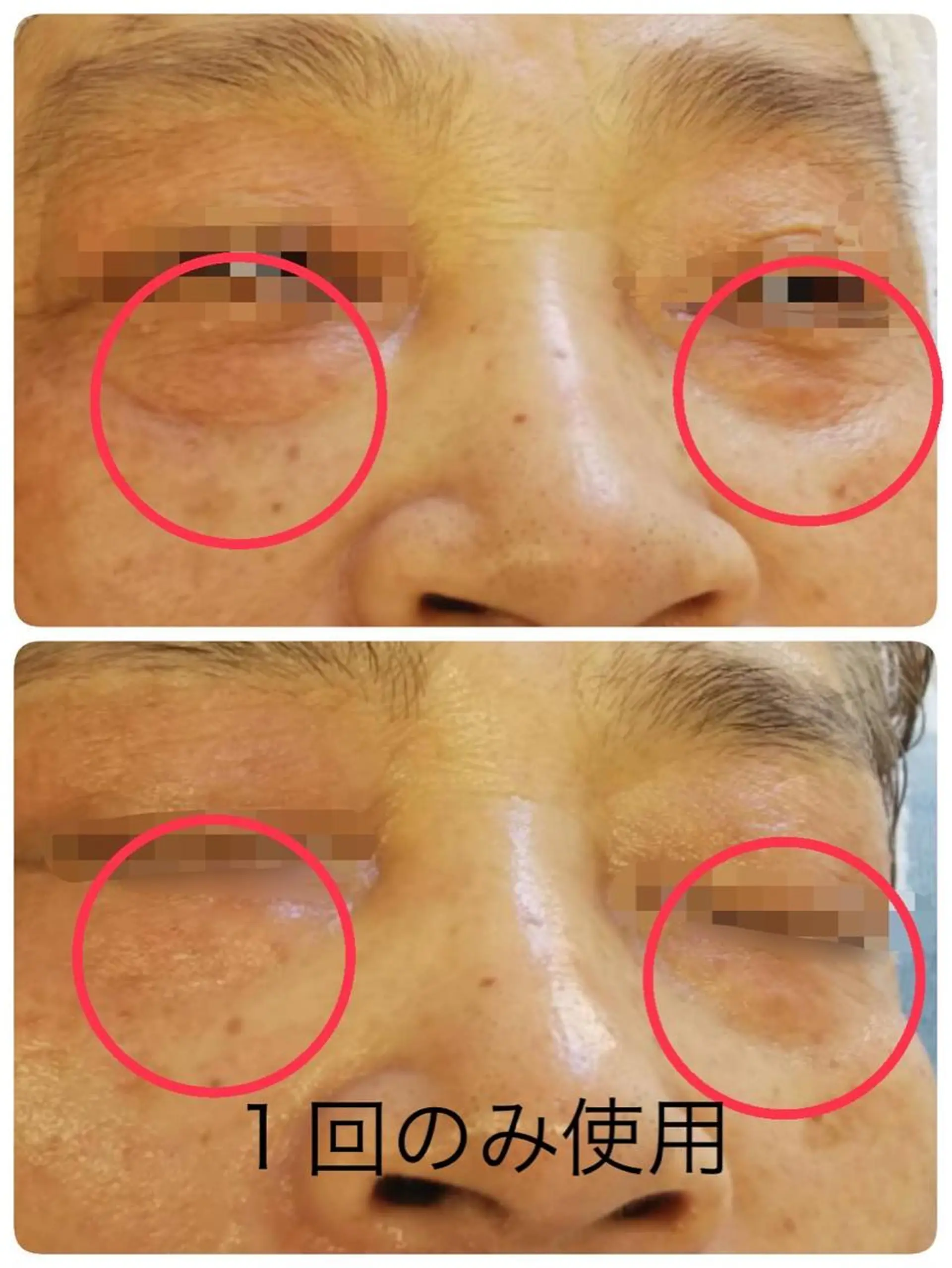 シミシワタルミ改善 美肌サロン松本浩美のエステ・リラクイメージ