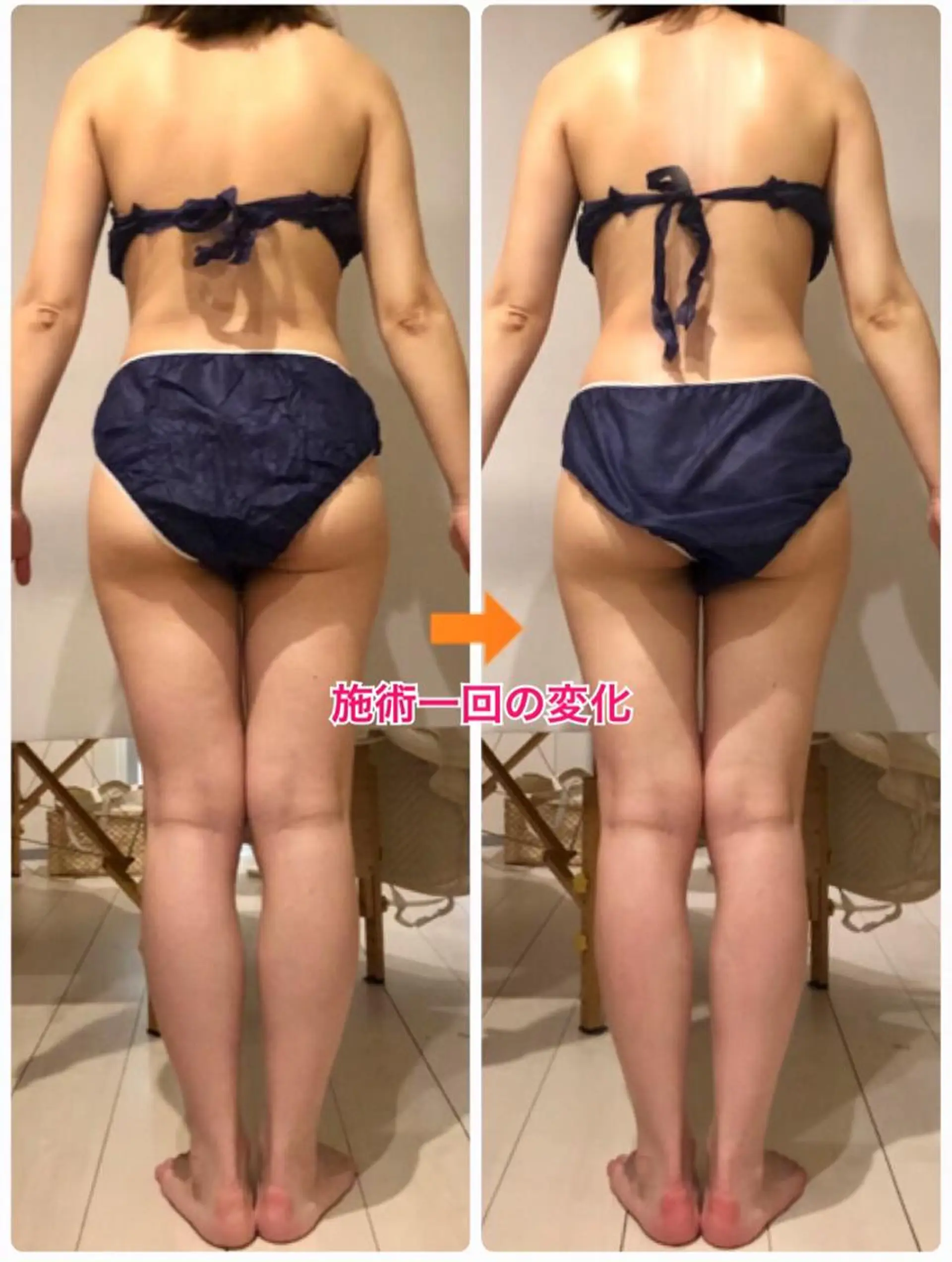 ロング カラー パーマ ヘアアレンジ メンズ キッズ ネイル マツエク・マツパ ‍痩身＆ボディ 結果出し🌟丹野のエステ・リラクイメージ