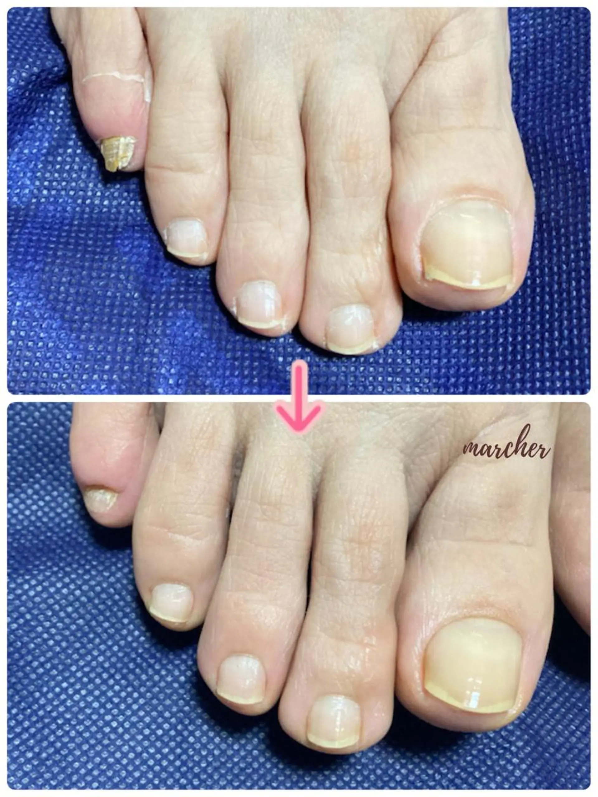 ネイル フットネイル Nailbeauty marcherのネイルデザイン