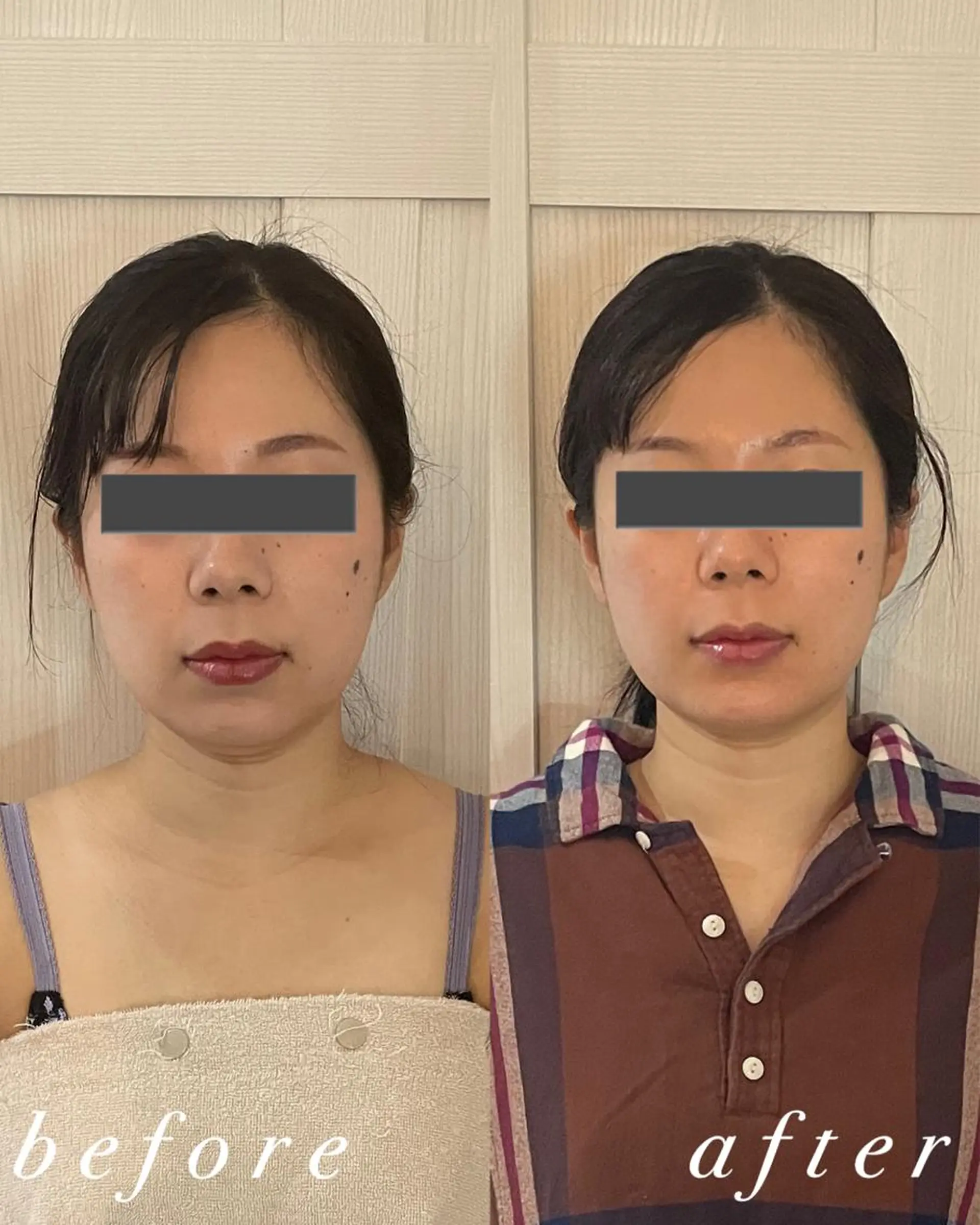 うなじ脱毛/美肌脱毛 LABELのエステ・リラクイメージ