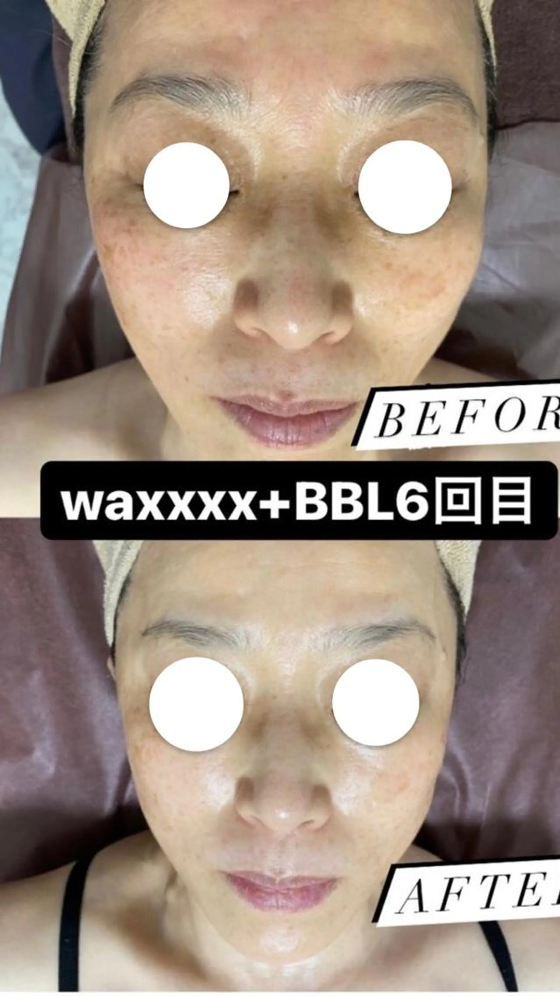 脱毛 Epina 千葉店 【エピナ】のエステ・リラクイメージ