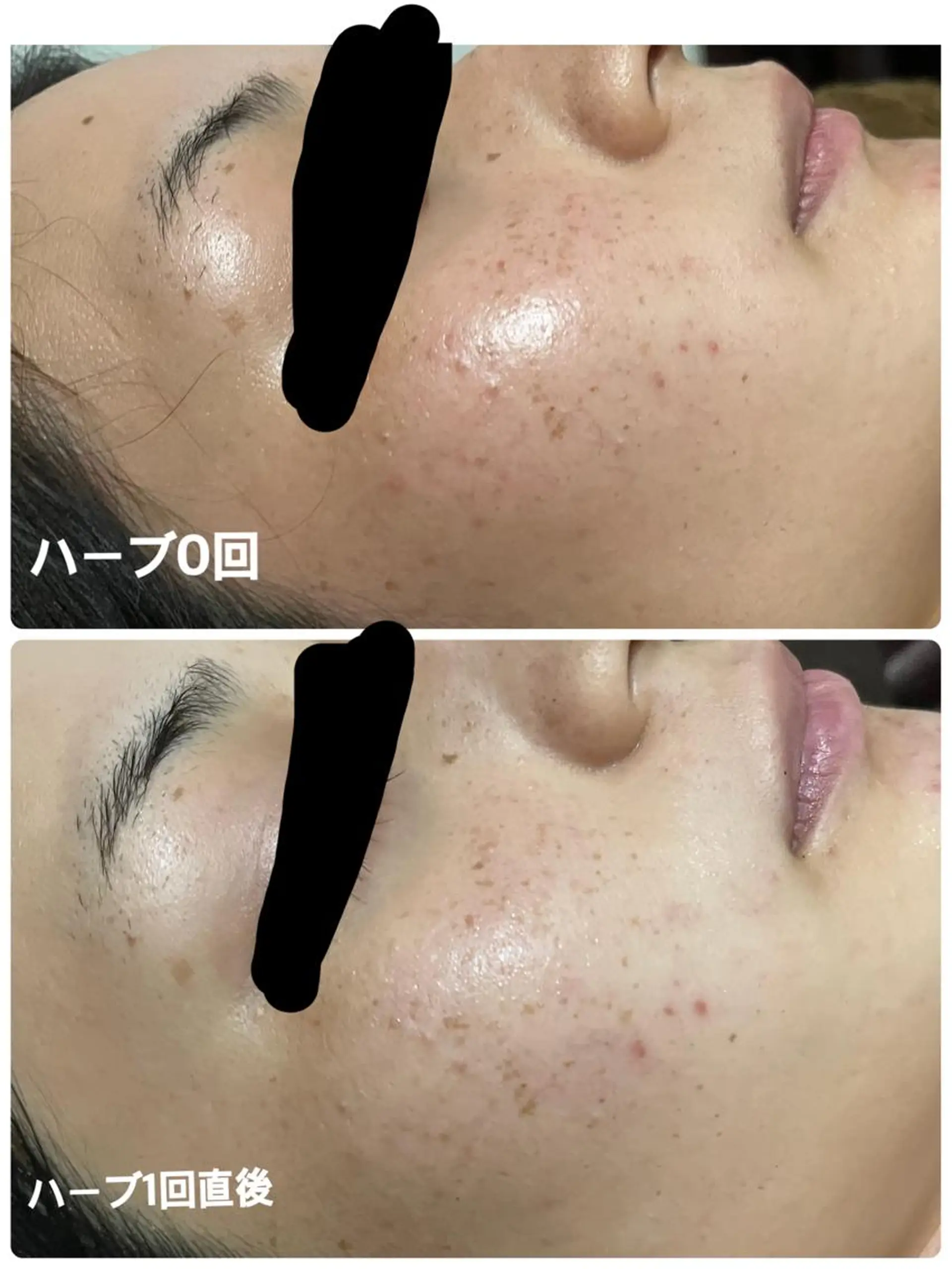 SALON BioBioのエステ・リラクイメージ