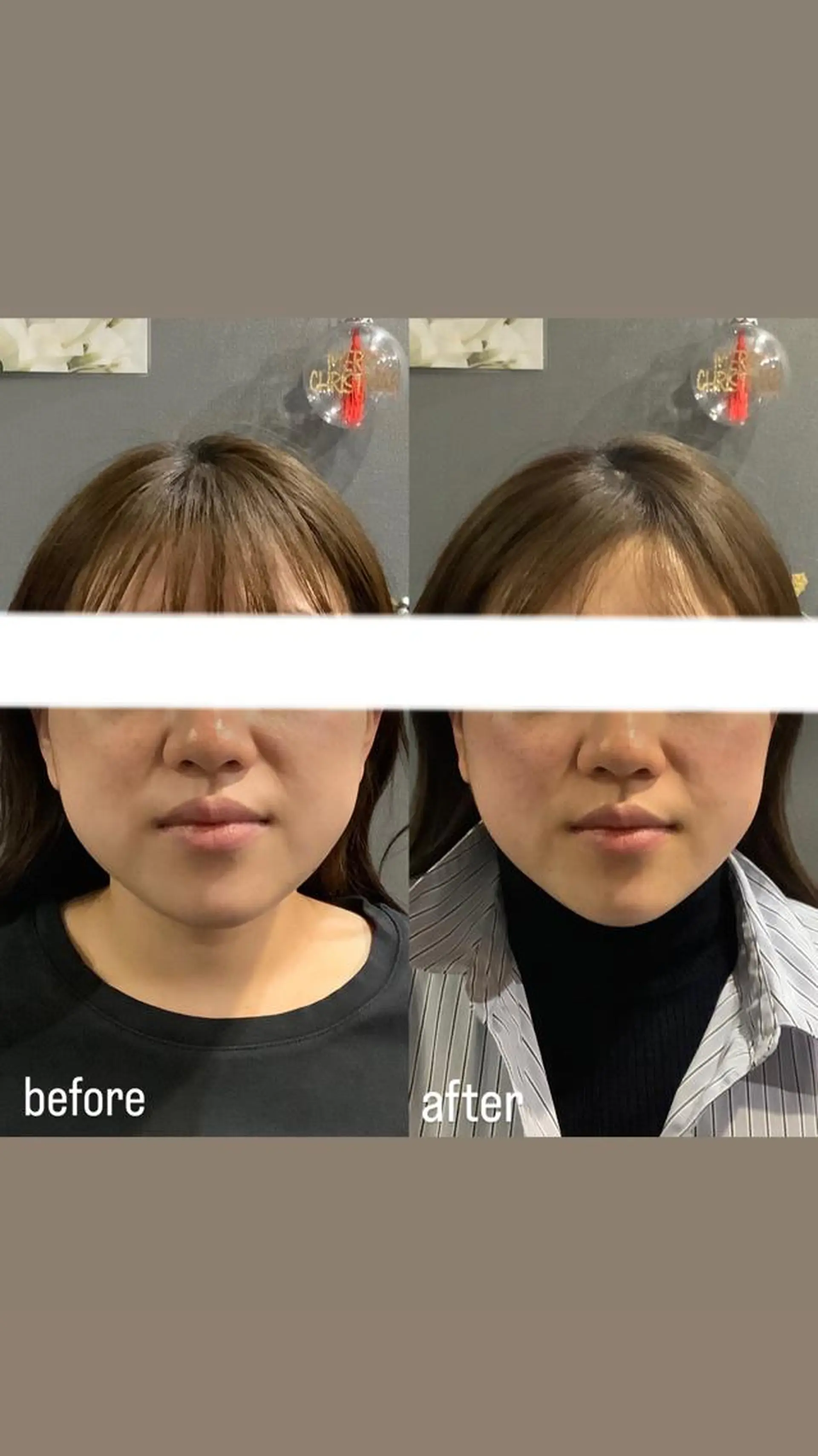 エステ リラク エステサロンino.colore'所属・小顔サロン ino.coloreのエステ・リラクイメージ