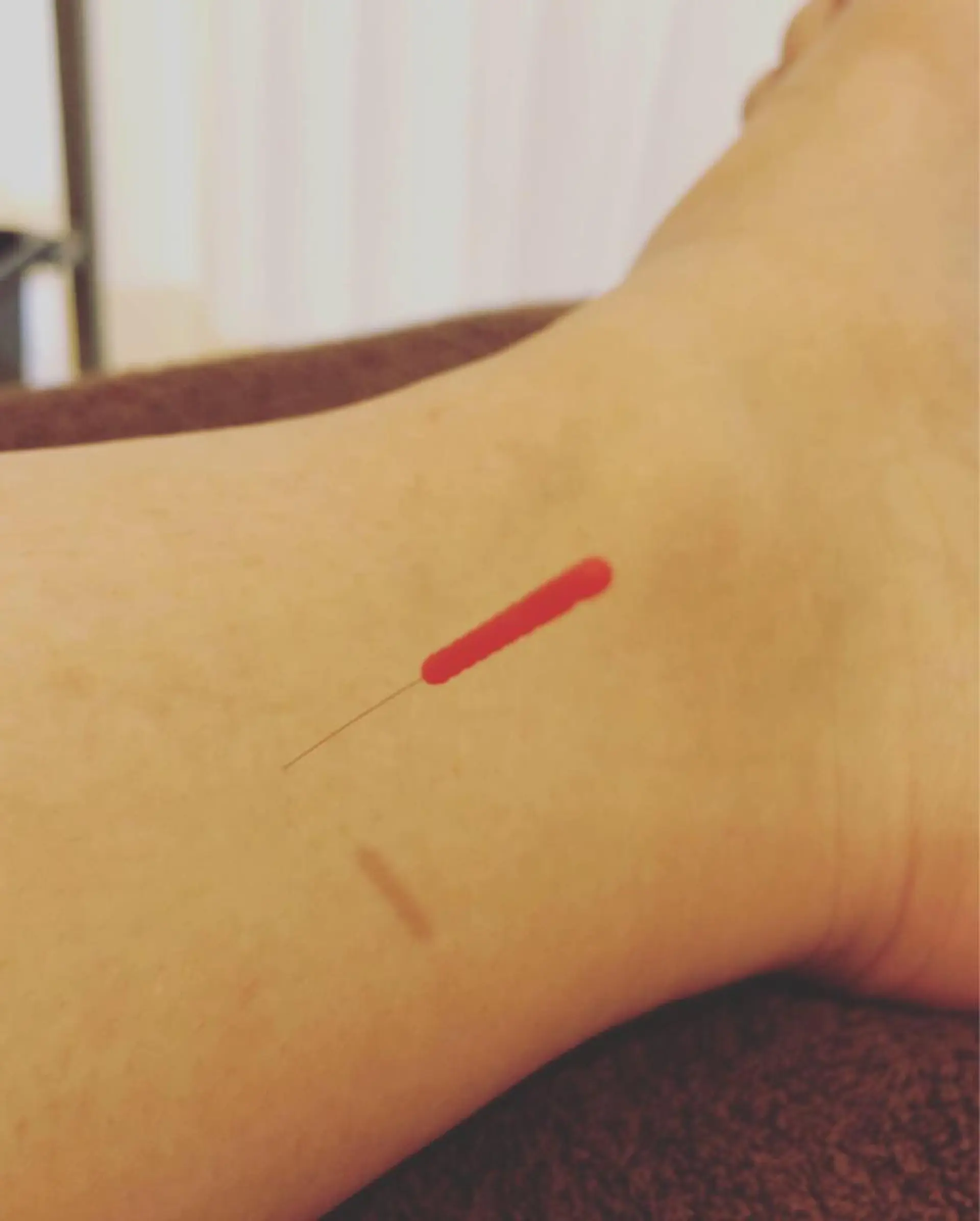 妙蓮寺ゆう鍼灸院所属・太田祐志 /中医美容鍼のエステ・リラクイメージ