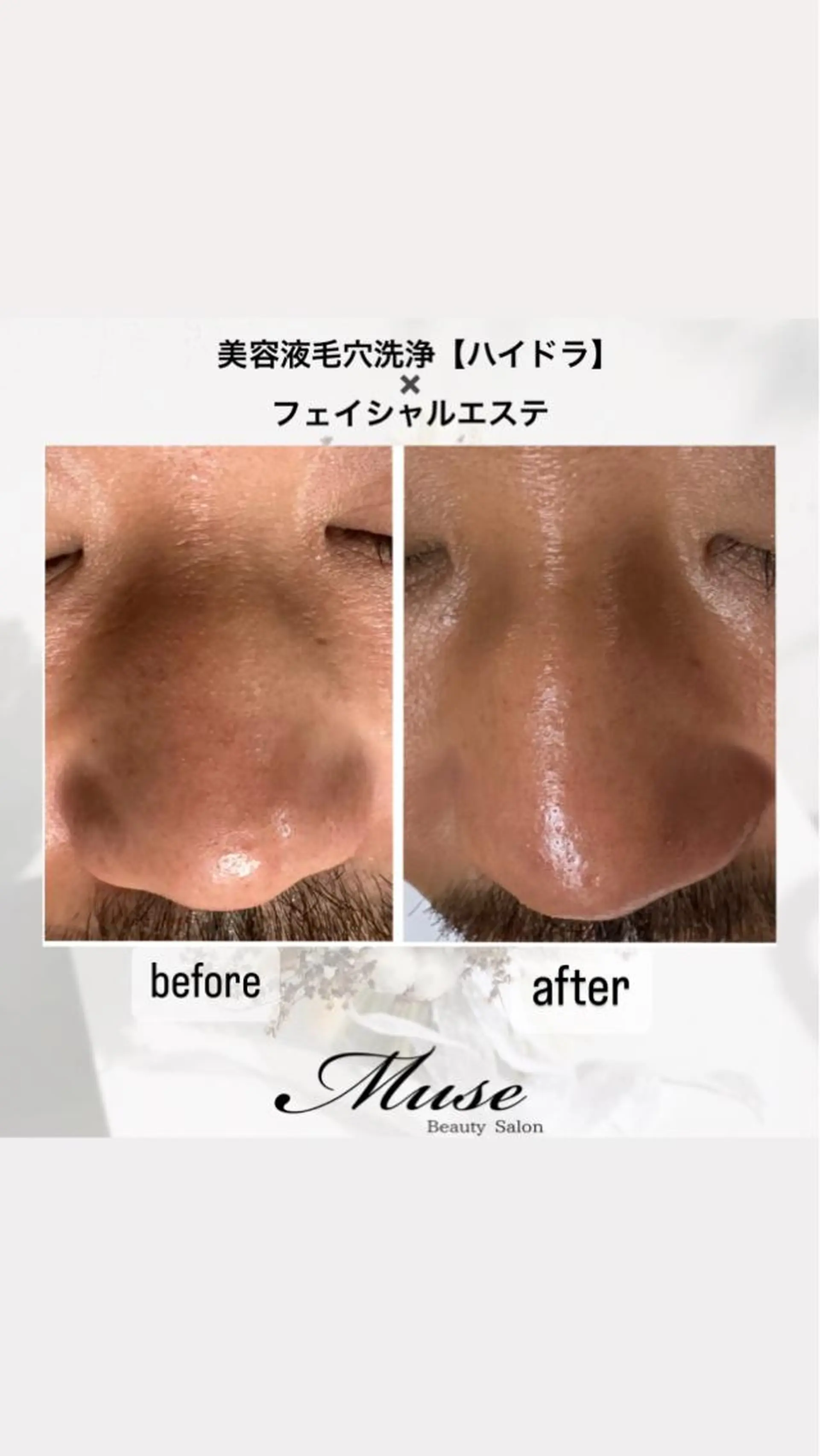 医療提携Beauty SalonMuseのエステ・リラクイメージ