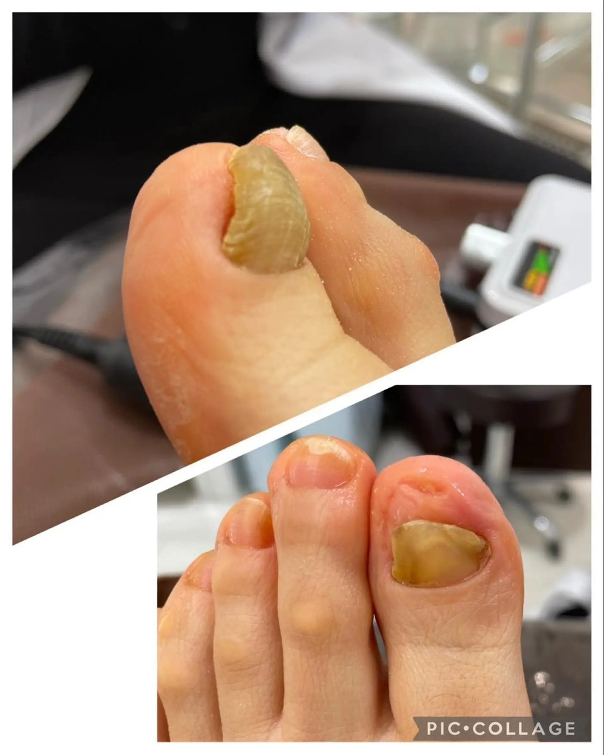 LIZERA&CO（charitesfam内）所属・南古谷　松本 かよのネイルデザイン