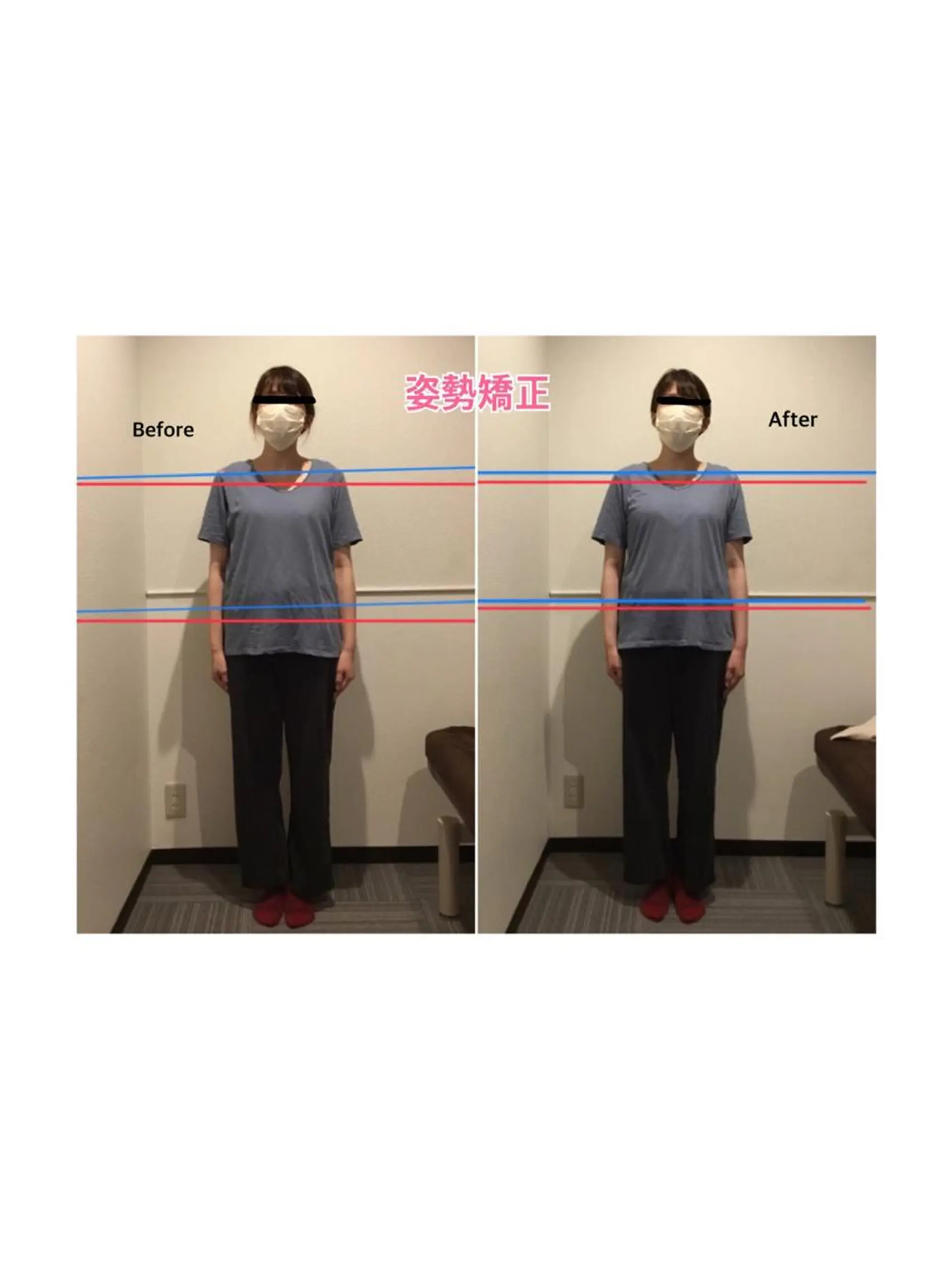 チキバン美容鍼灸整体 サロン心斎橋店のエステ・リラクイメージ